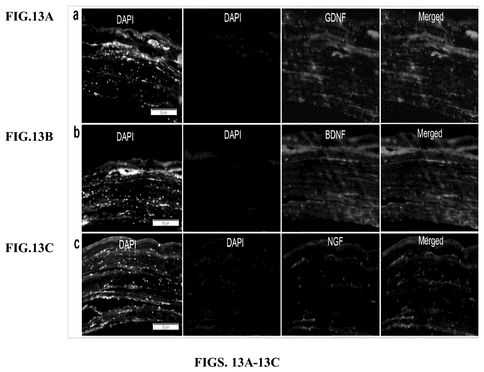 Patent US12599634 Figure 14 – Nerve guidance conduit comprising neural crest stem-like cells and/or Schwann cell precursor-like cells and methods of making and using the same