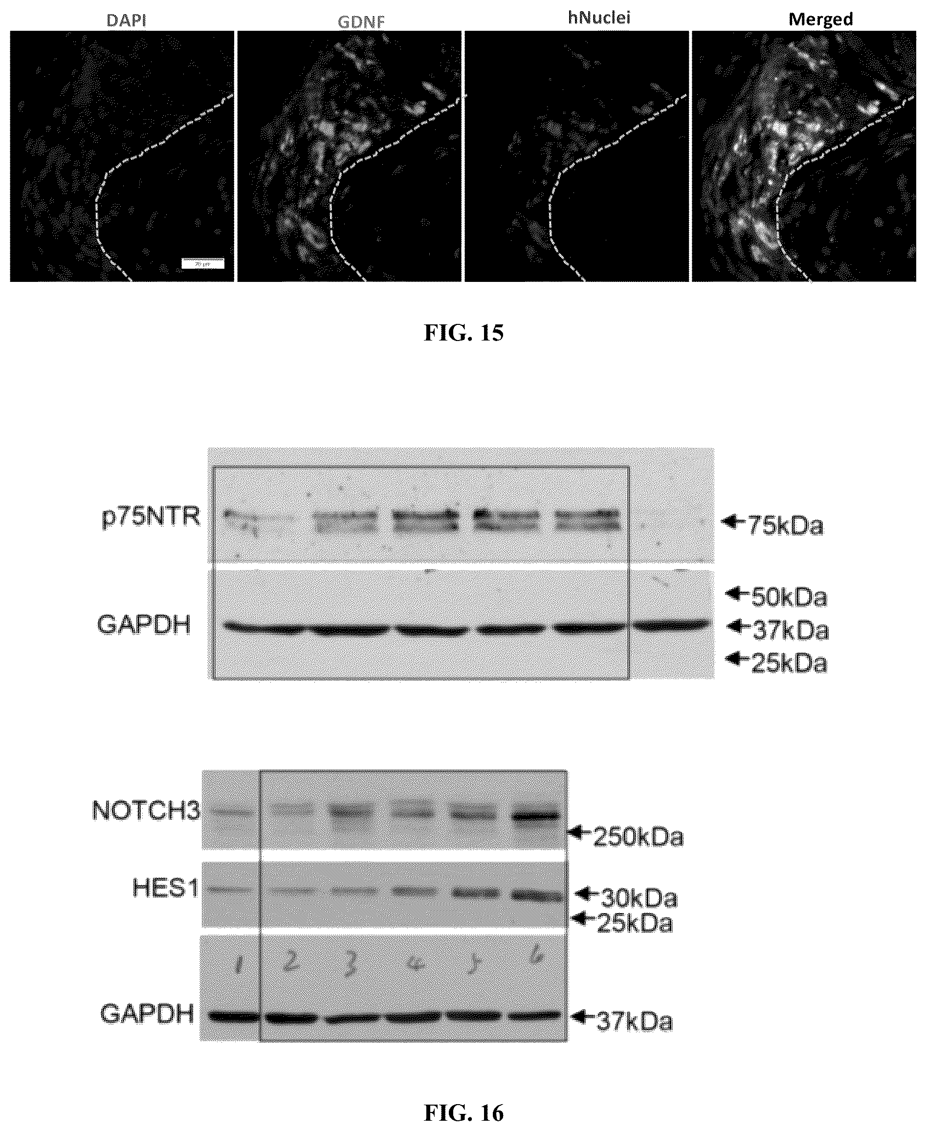 Patent US12599634 Figure 16 – Nerve guidance conduit comprising neural crest stem-like cells and/or Schwann cell precursor-like cells and methods of making and using the same