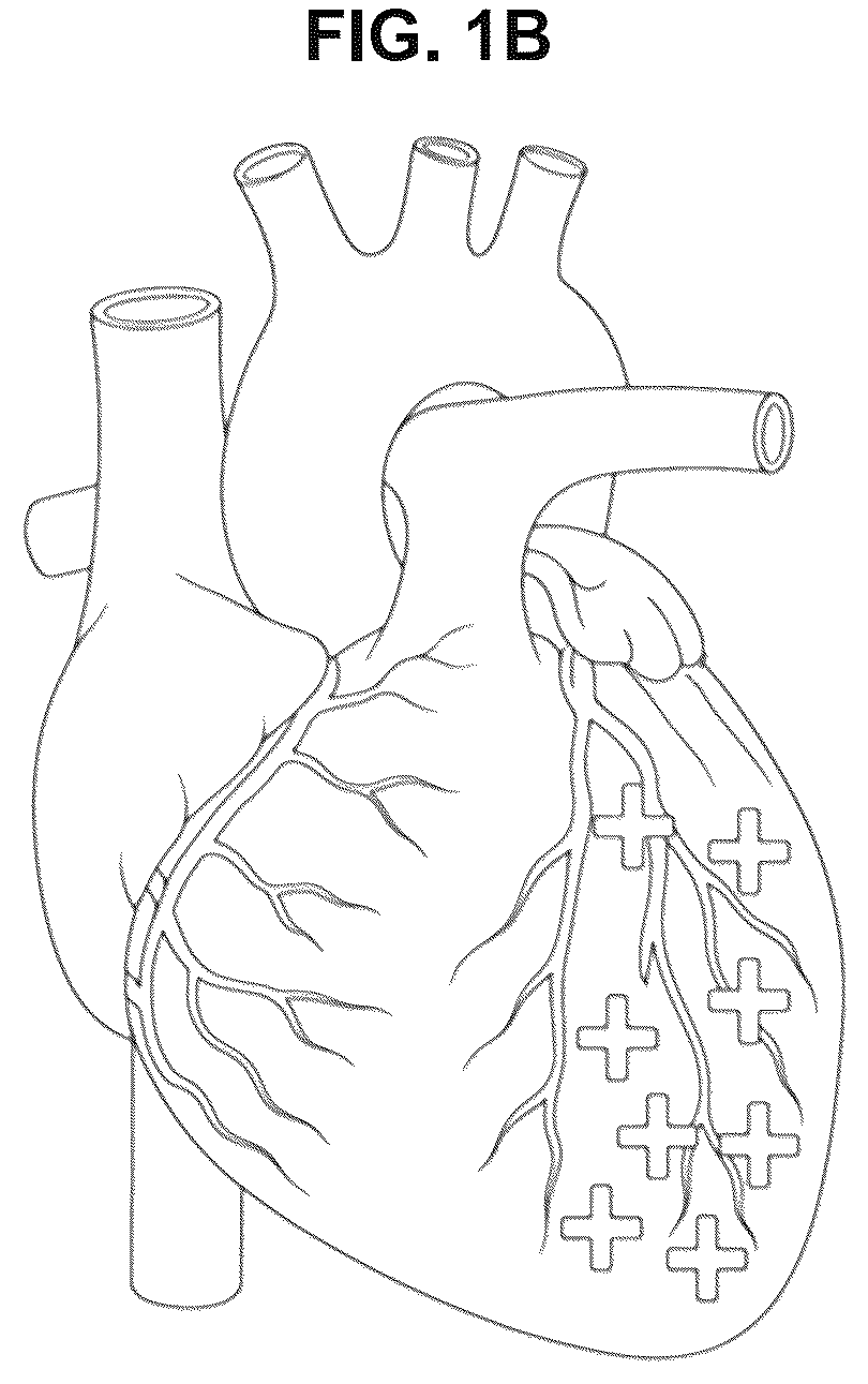 Patent US12599635 Figure 2 – Compositions and treatments for ischemic injuries