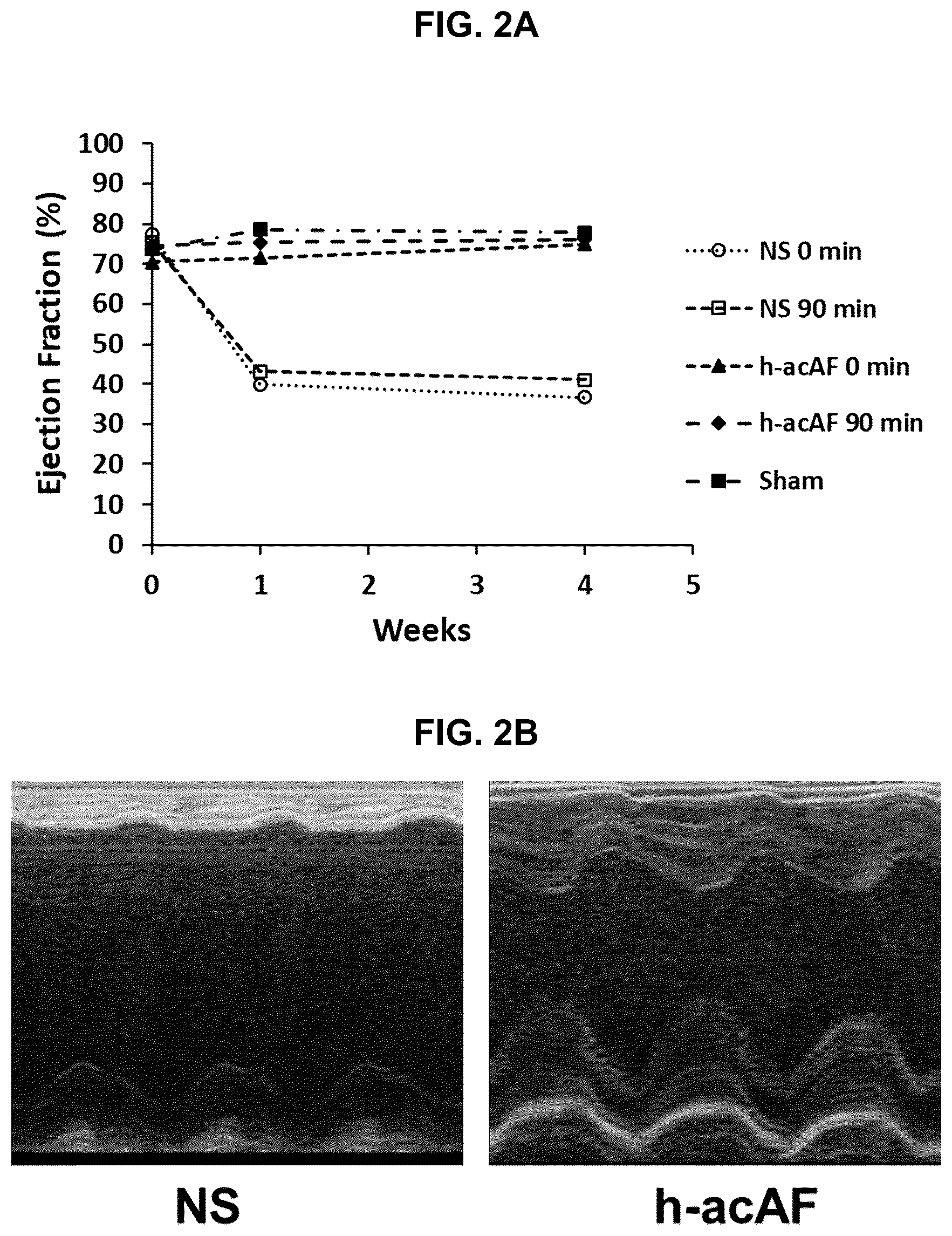 Patent US12599635 Figure 4 – Compositions and treatments for ischemic injuries