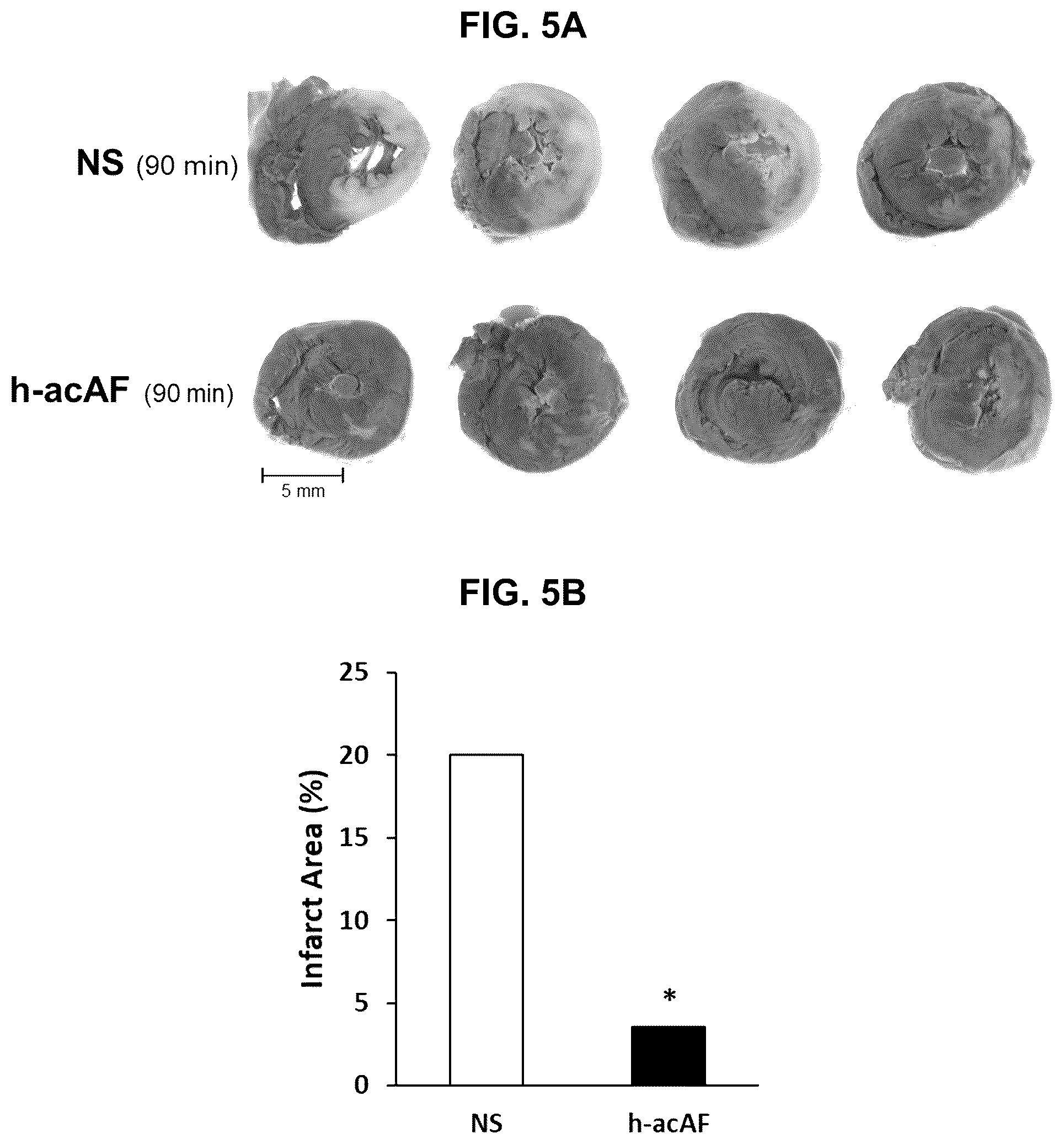 Patent US12599635 Figure 10 – Compositions and treatments for ischemic injuries