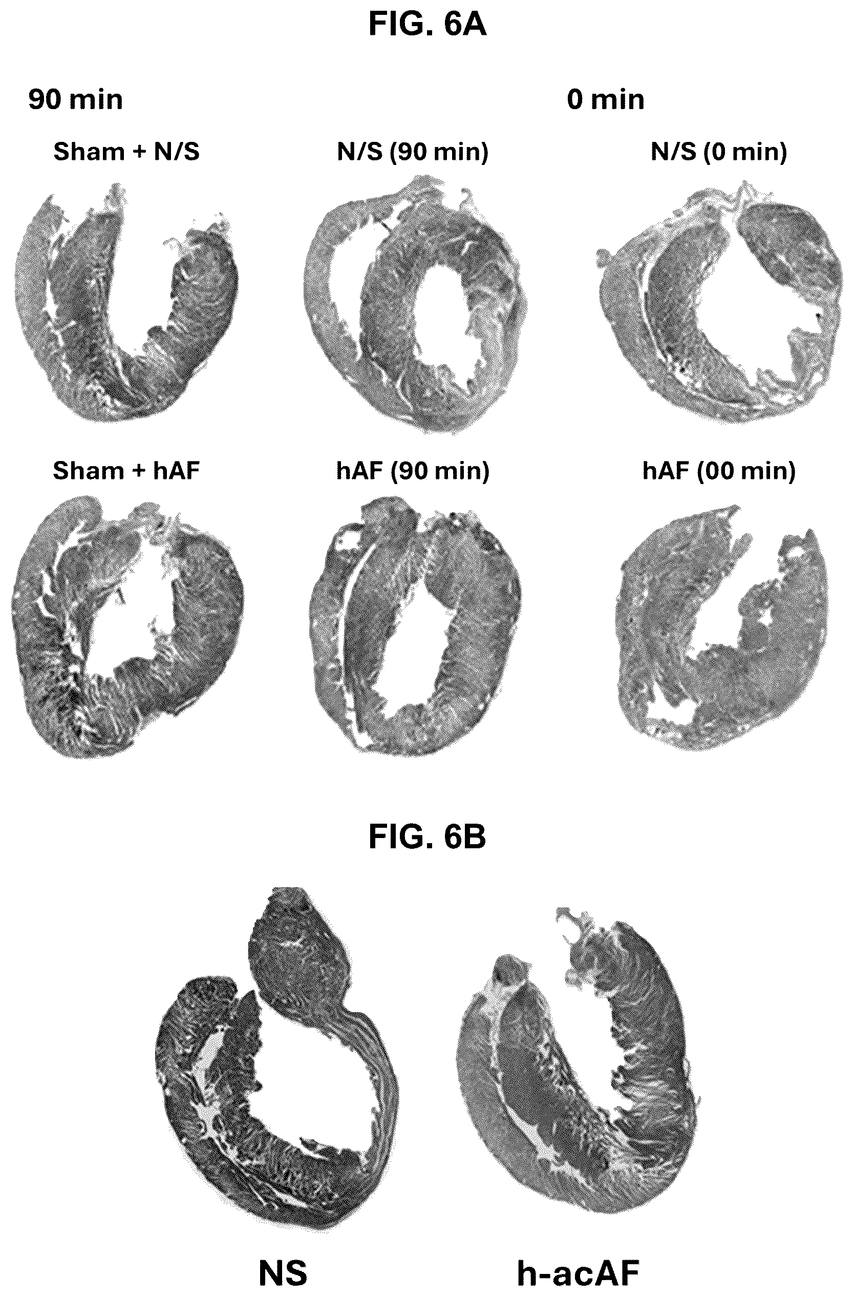 Patent US12599635 Figure 12 – Compositions and treatments for ischemic injuries