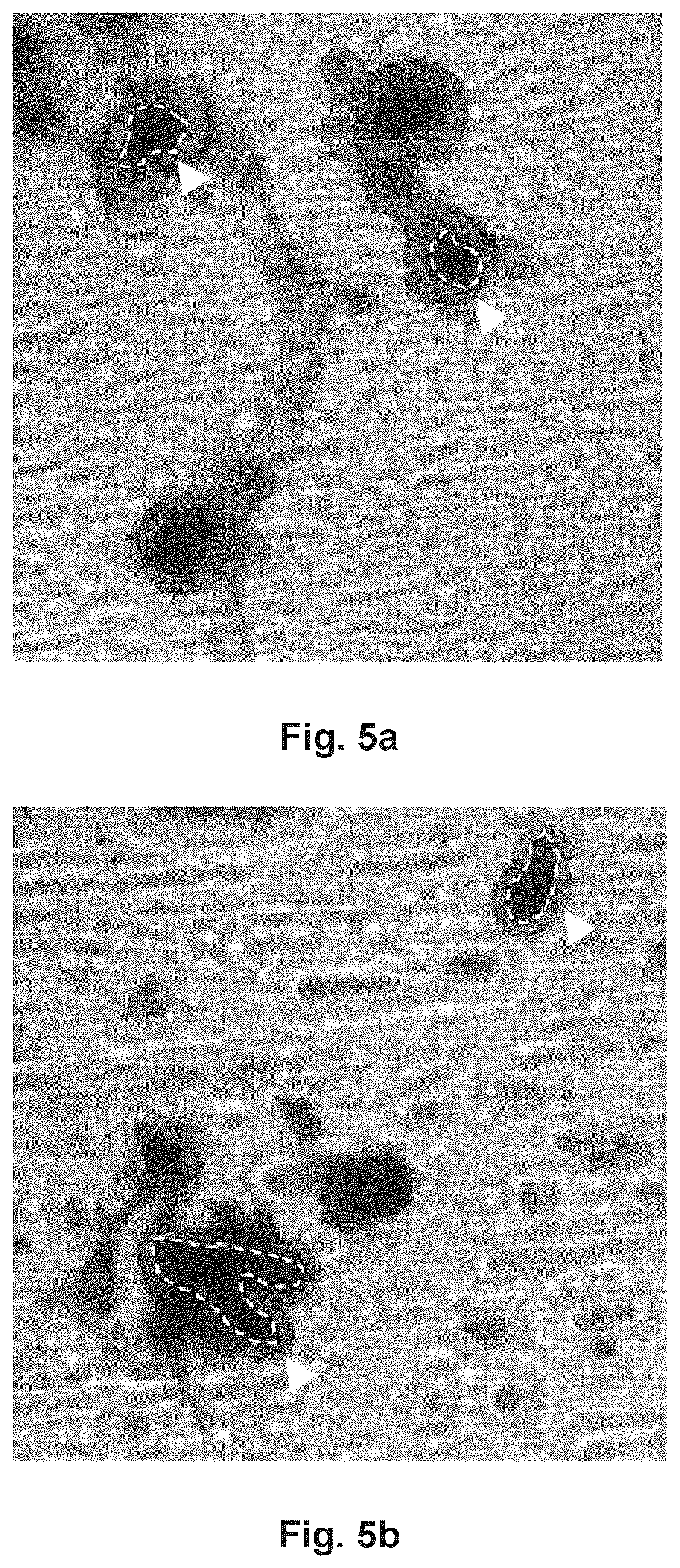 Patent US12599648 Figure 7 – Pharmaceutical composition comprising a combination of a guanylate cyclase C (GUCY2C) agonist and a short-chain fatty acid or prodrug thereof