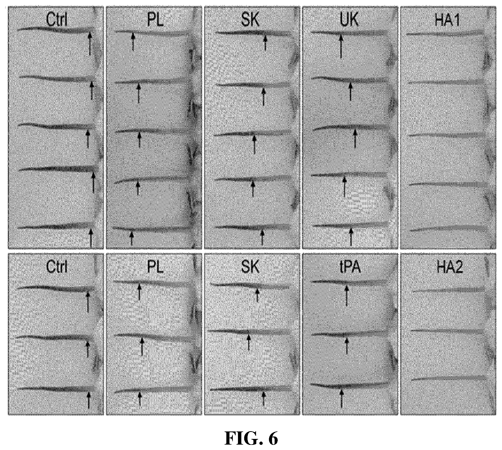Patent US12599653 Figure 5 – Thrombolytic agents for intravascular clots