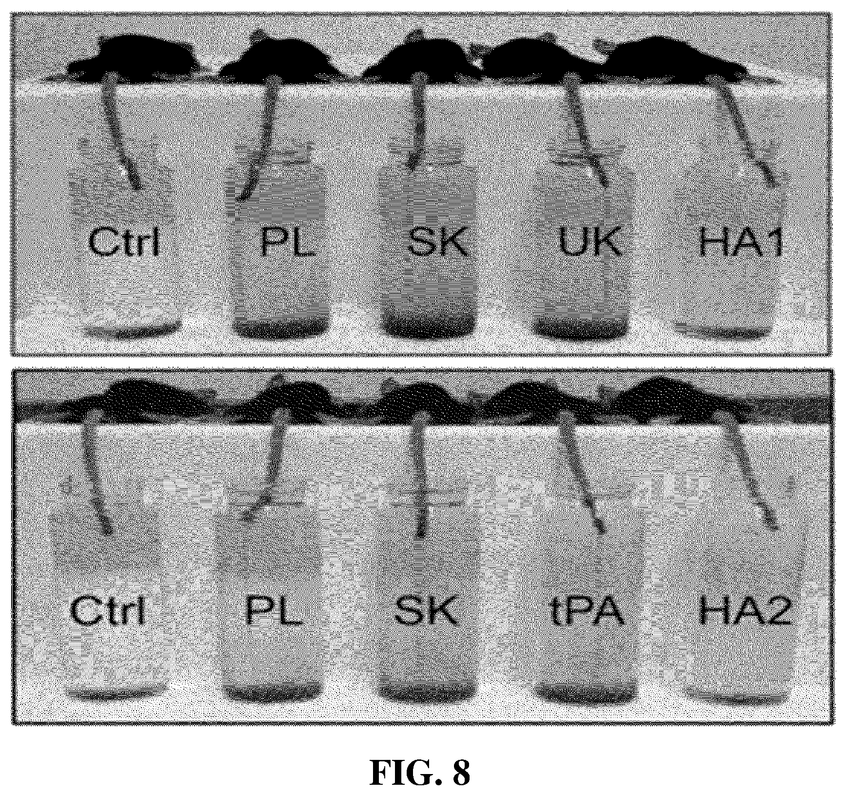 Patent US12599653 Figure 7 – Thrombolytic agents for intravascular clots
