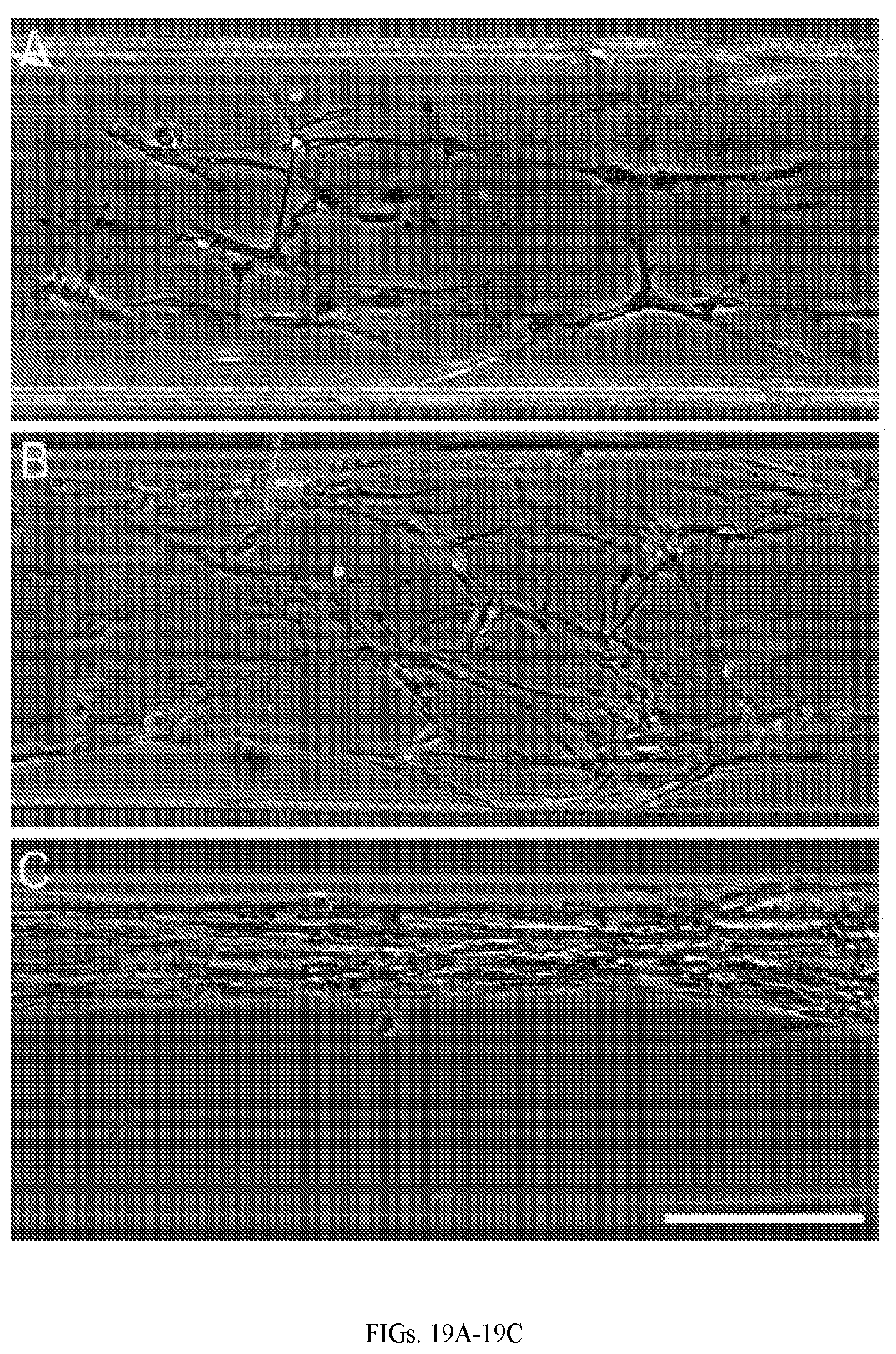 Patent US12599670 Figure 13 – Composition comprising three-dimensional astrocyte bundles of bi-polar and aligned astrocyte processes and a method of making thereof