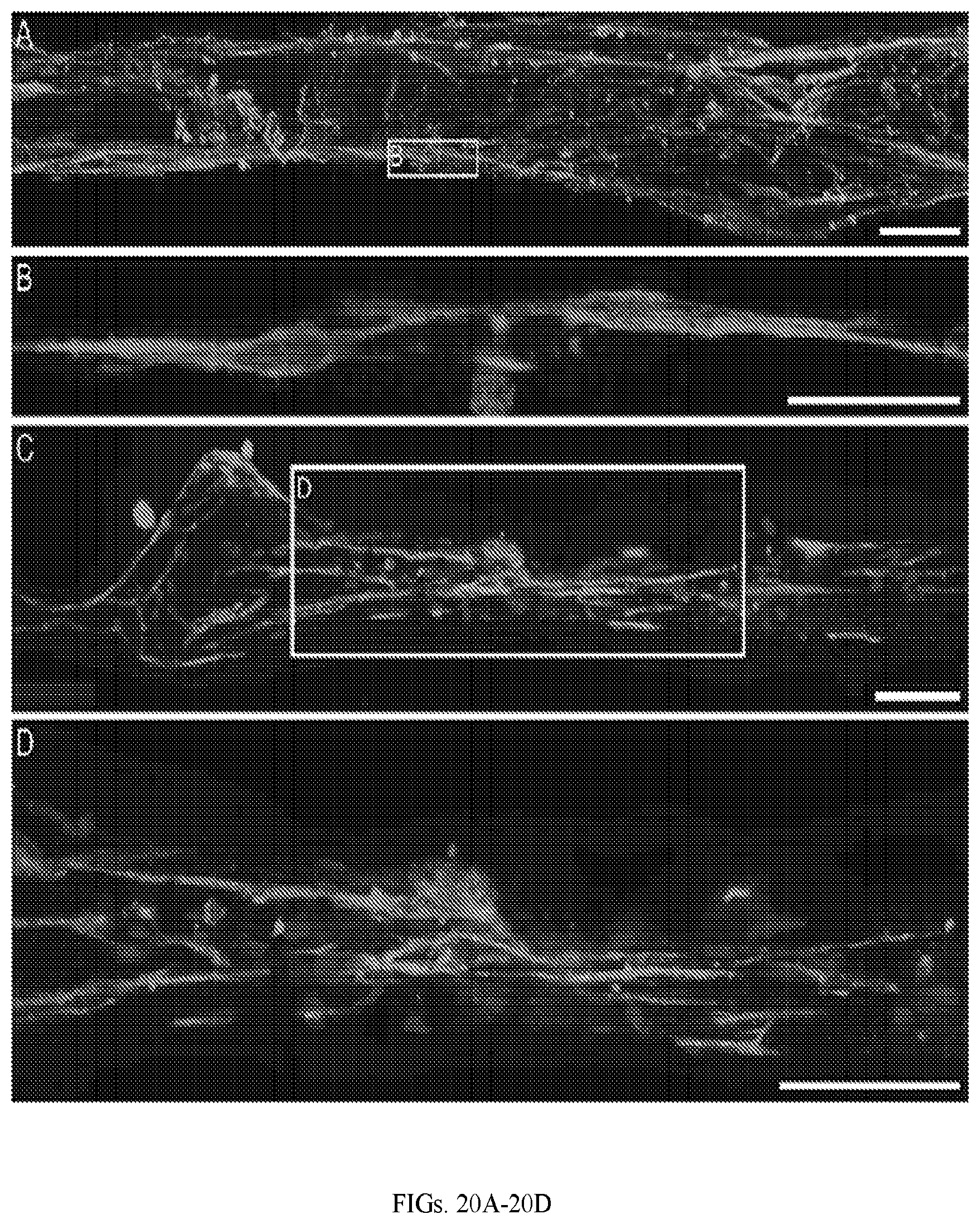 Patent US12599670 Figure 14 – Composition comprising three-dimensional astrocyte bundles of bi-polar and aligned astrocyte processes and a method of making thereof