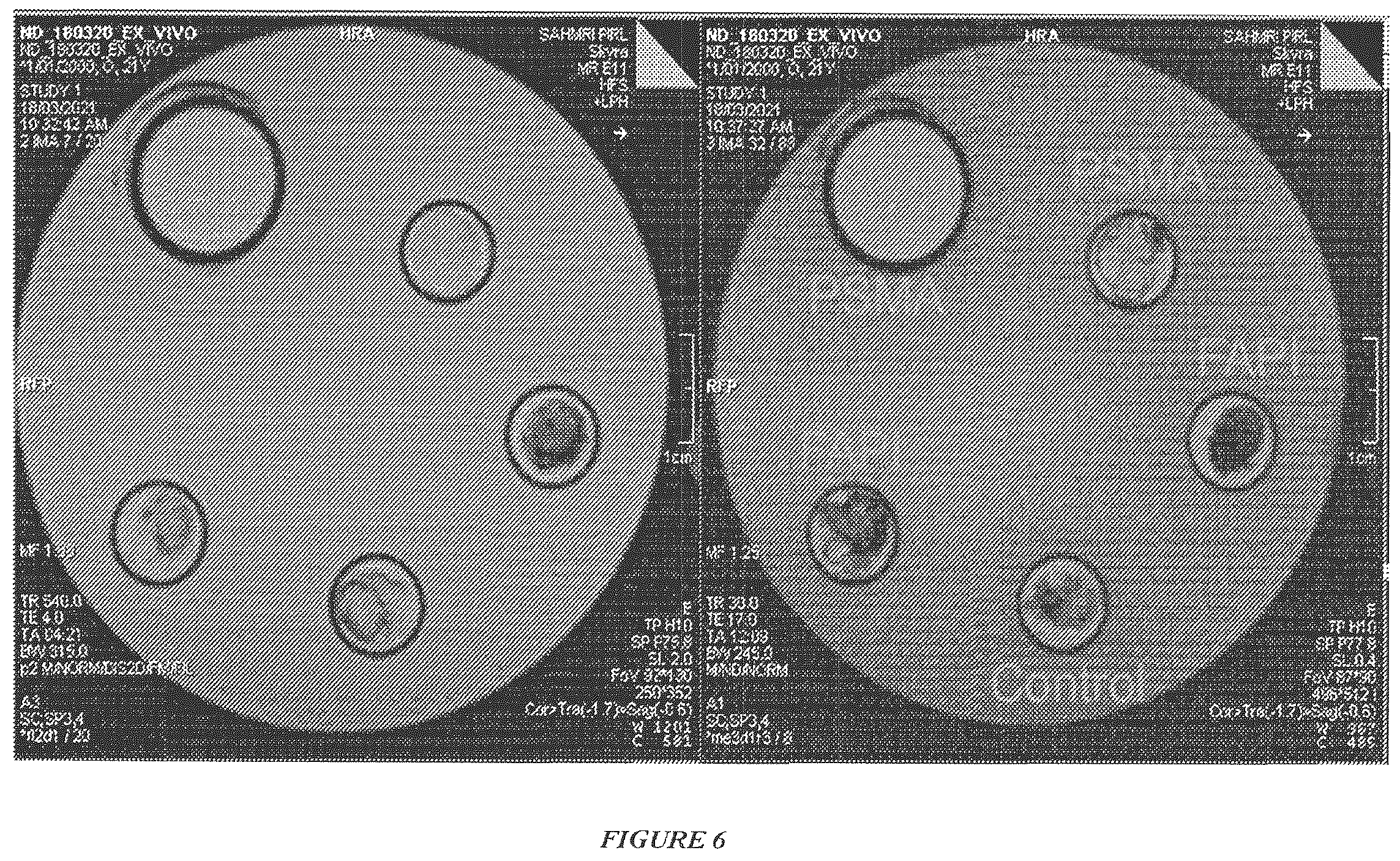 Patent US12599683 Figure 4 – Mapping nanoparticles