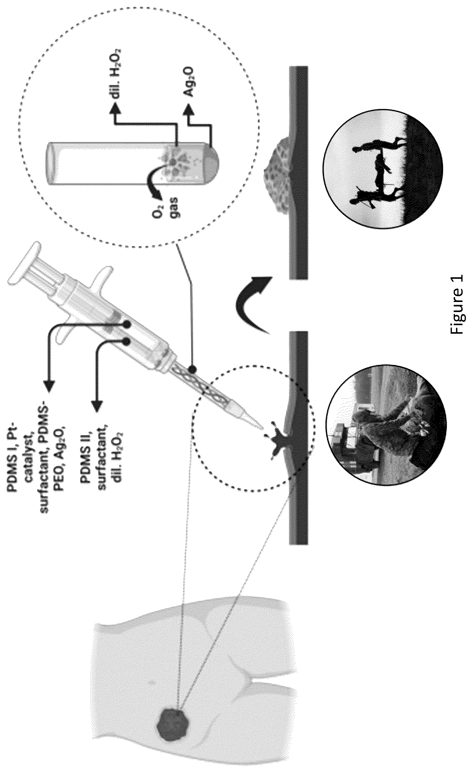 Patent US12599693 Figure 1 – Augmented thermoset polymer sponges for in situ hemostatic treatment of external and internal wounds