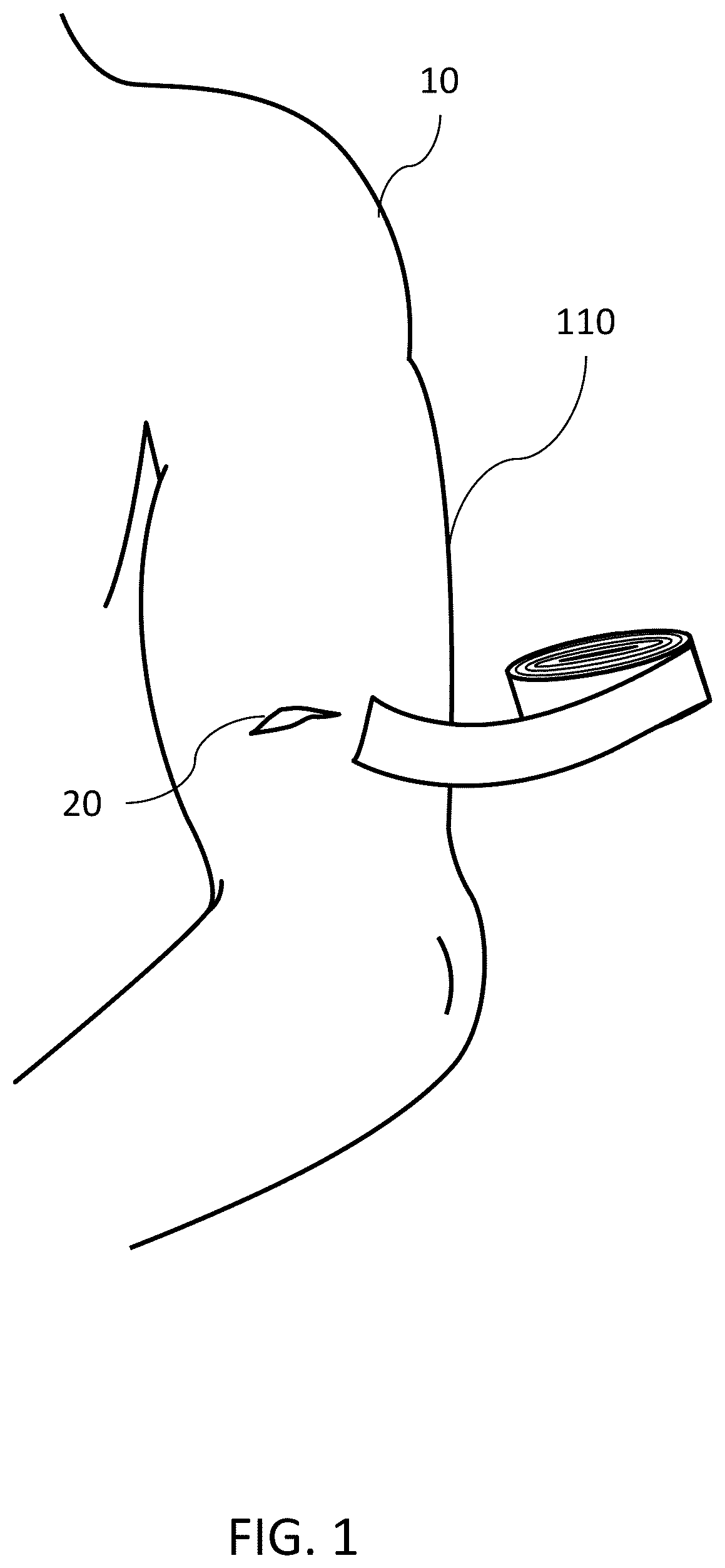 Patent US12599694 Figure 1 – Scaffold wound dressing