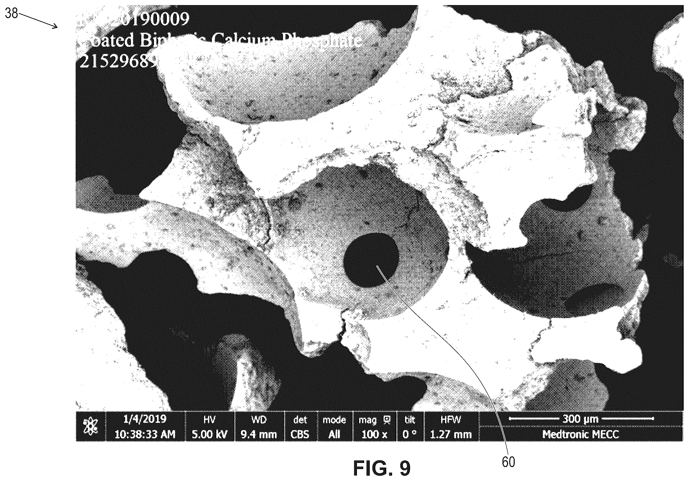 Patent US12599696 Figure 9 – Hydratable and flowable implantable compositions and methods of making and using them