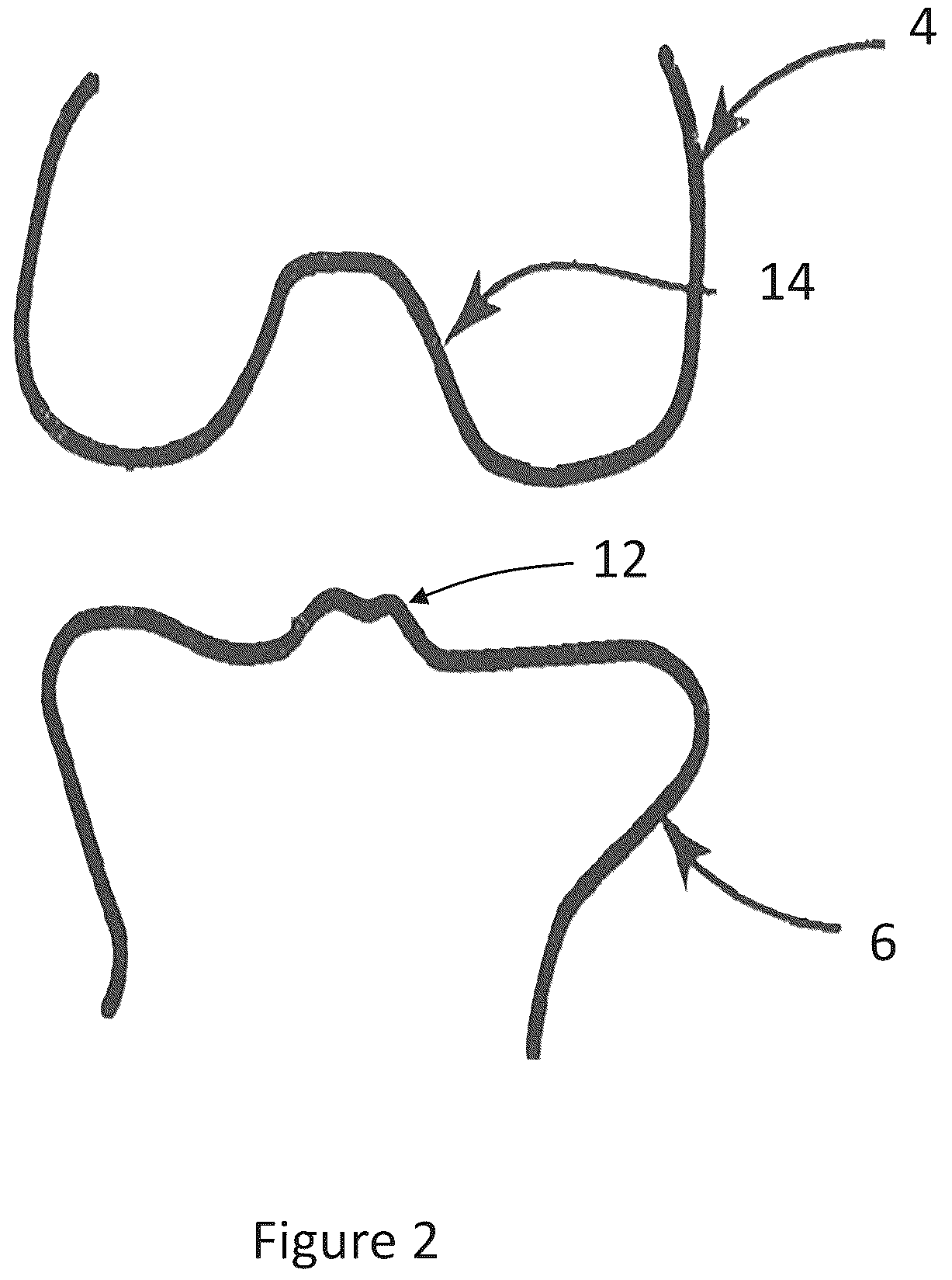 Patent US12599700 Figure 2 – System and methods for connective tissue repair using scaffolds