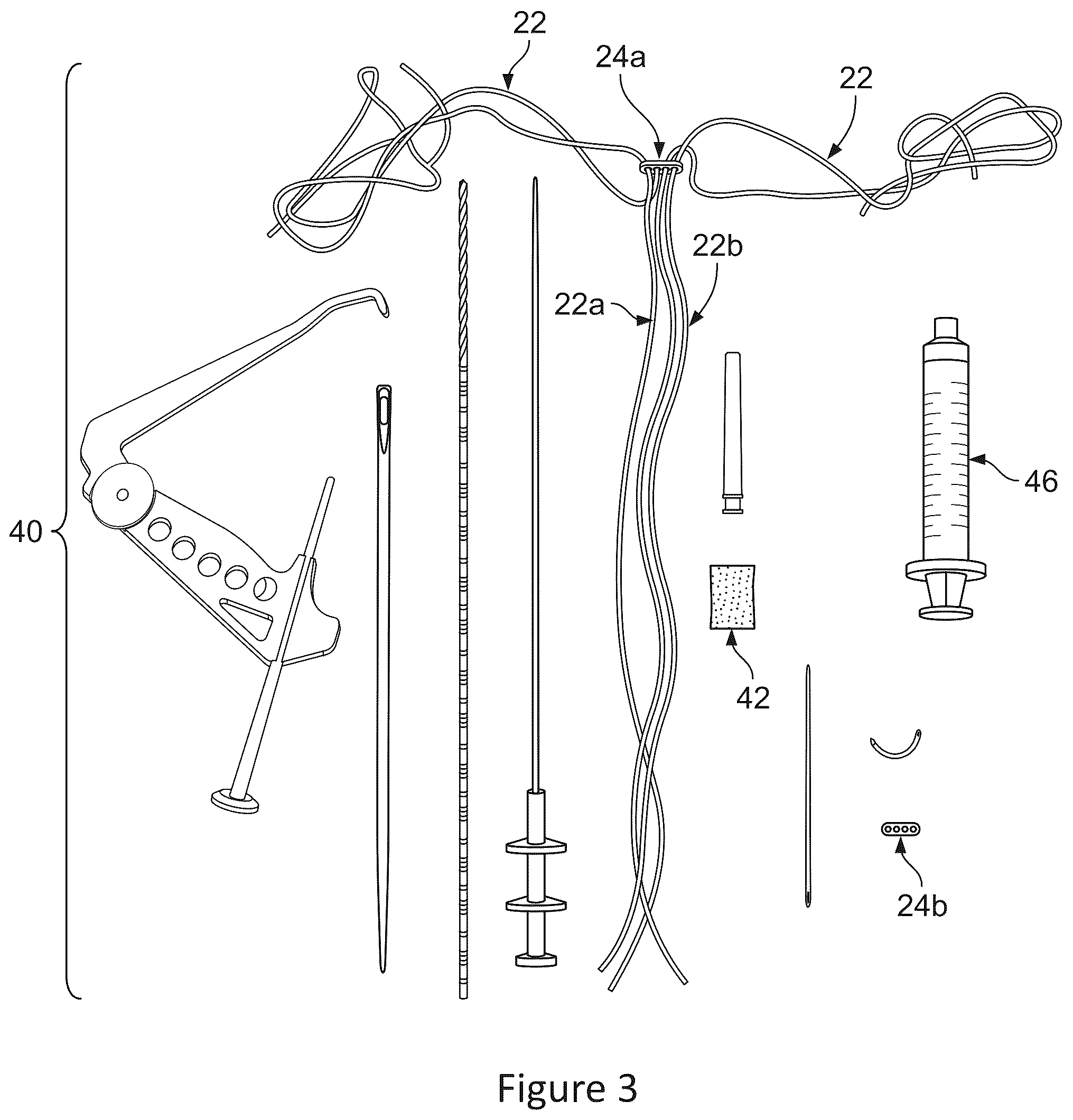 Patent US12599700 Figure 3 – System and methods for connective tissue repair using scaffolds