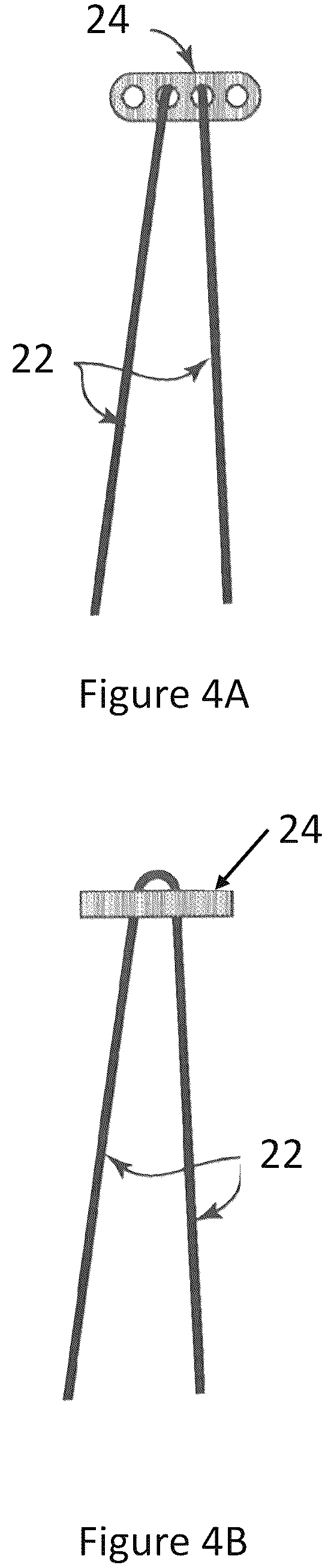 Patent US12599700 Figure 4 – System and methods for connective tissue repair using scaffolds