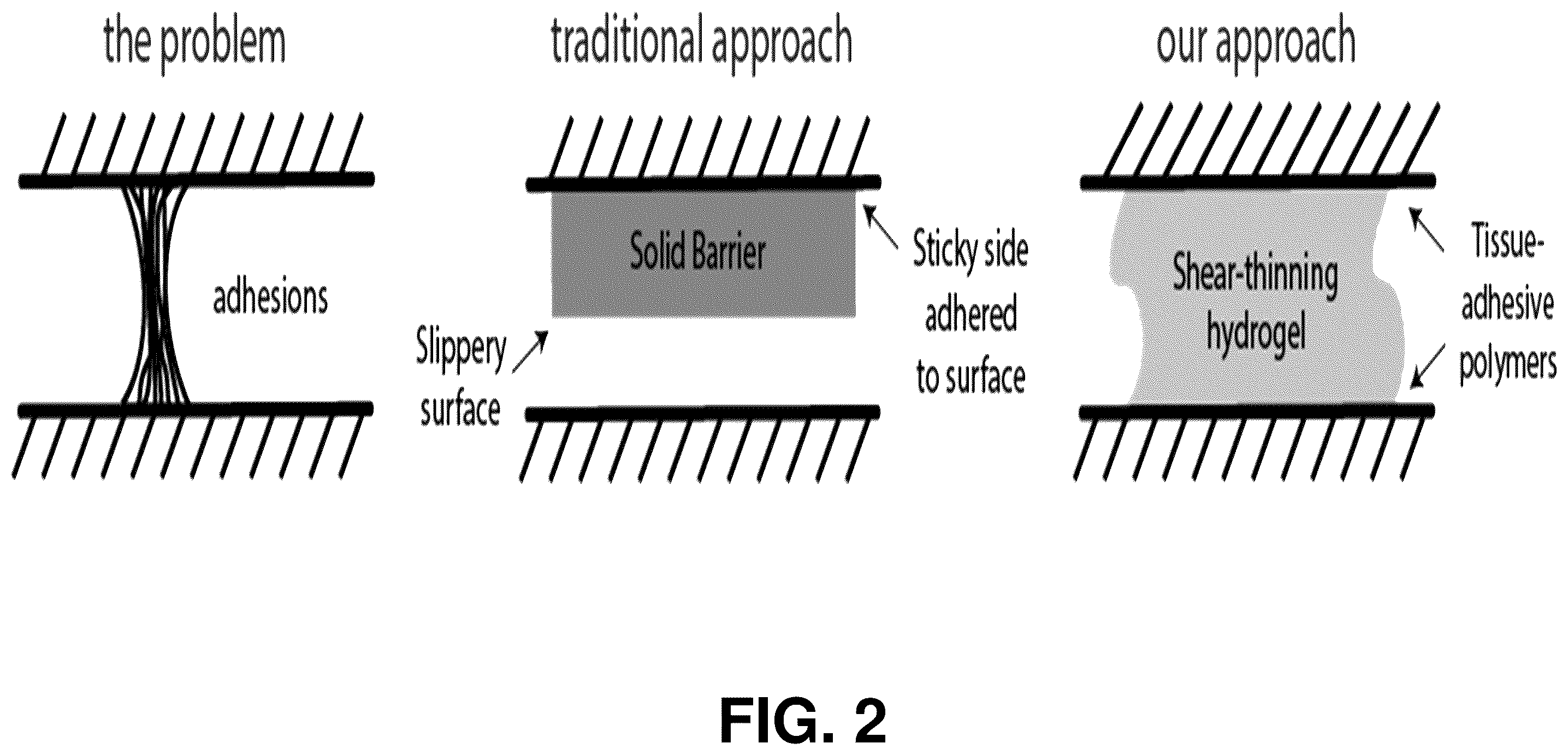 Patent US12599706 Figure 2 – Adhesion prevention with shear-thinning polymeric hydrogels