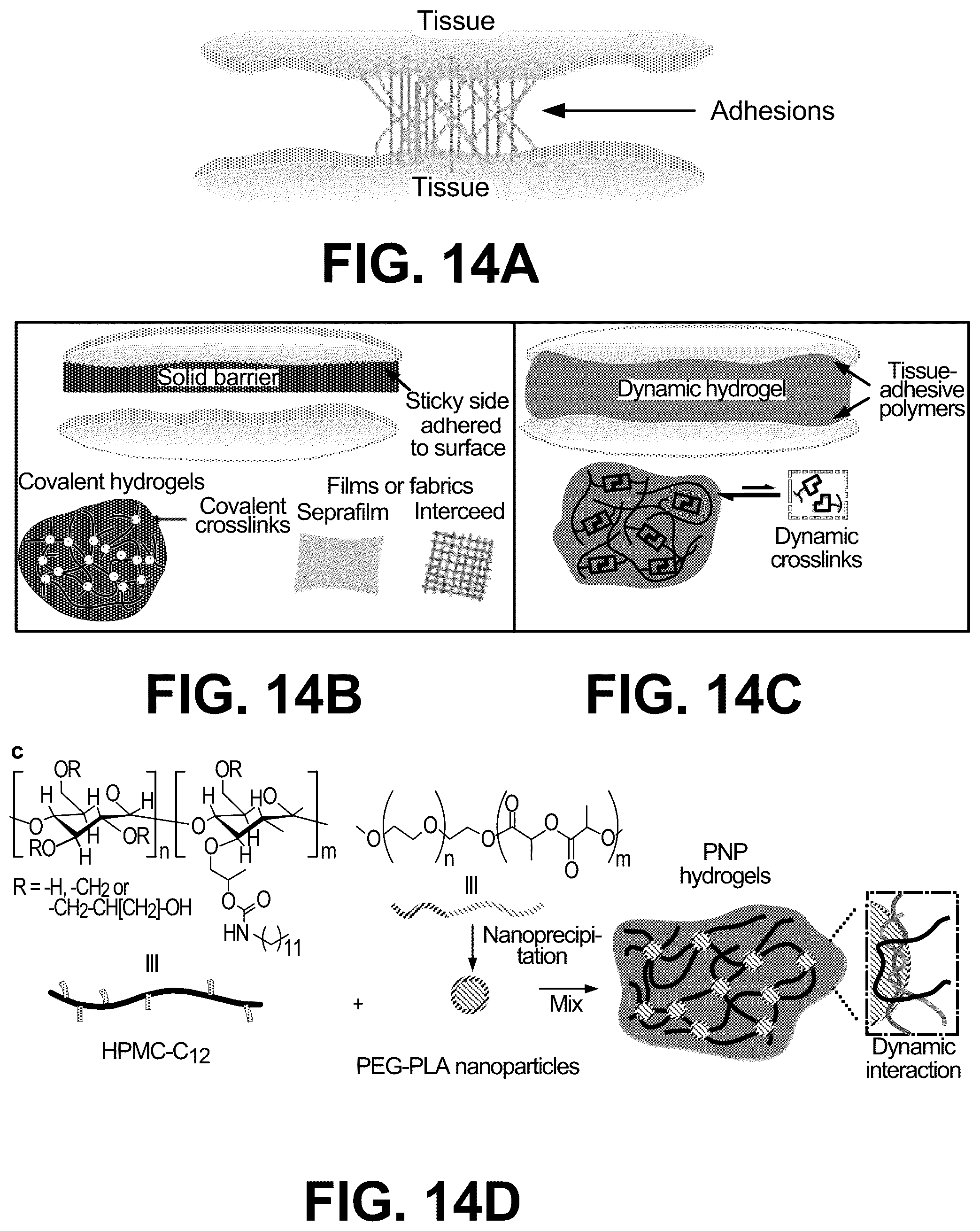 Patent US12599706 Figure 16 – Adhesion prevention with shear-thinning polymeric hydrogels