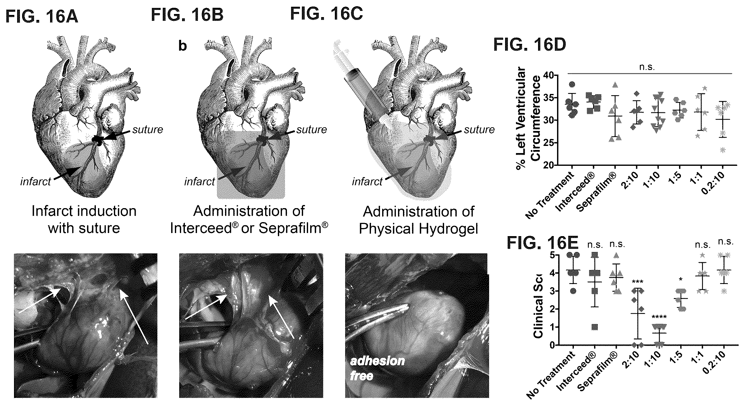 Patent US12599706 Figure 18 – Adhesion prevention with shear-thinning polymeric hydrogels