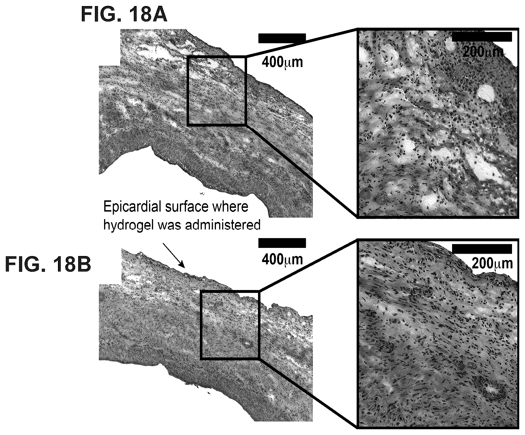 Patent US12599706 Figure 20 – Adhesion prevention with shear-thinning polymeric hydrogels