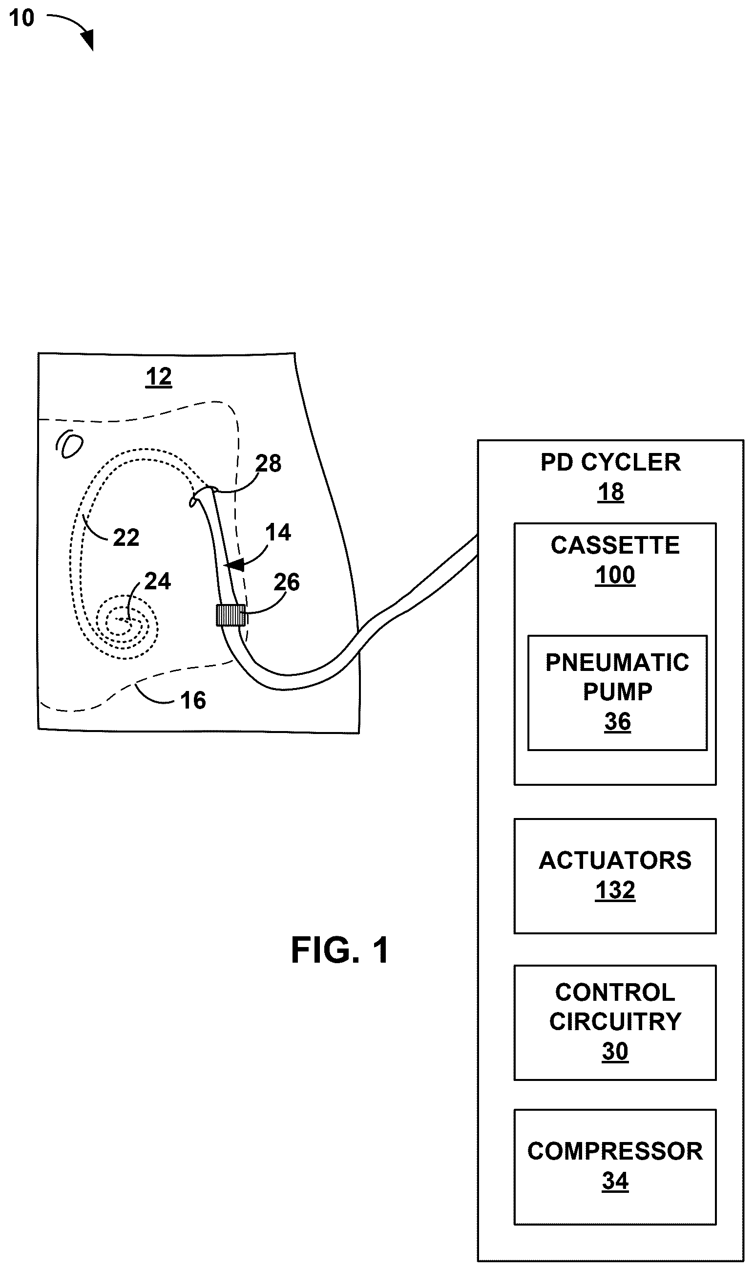 Patent US12599708 Figure 1 – Peritoneal dialysis cassette