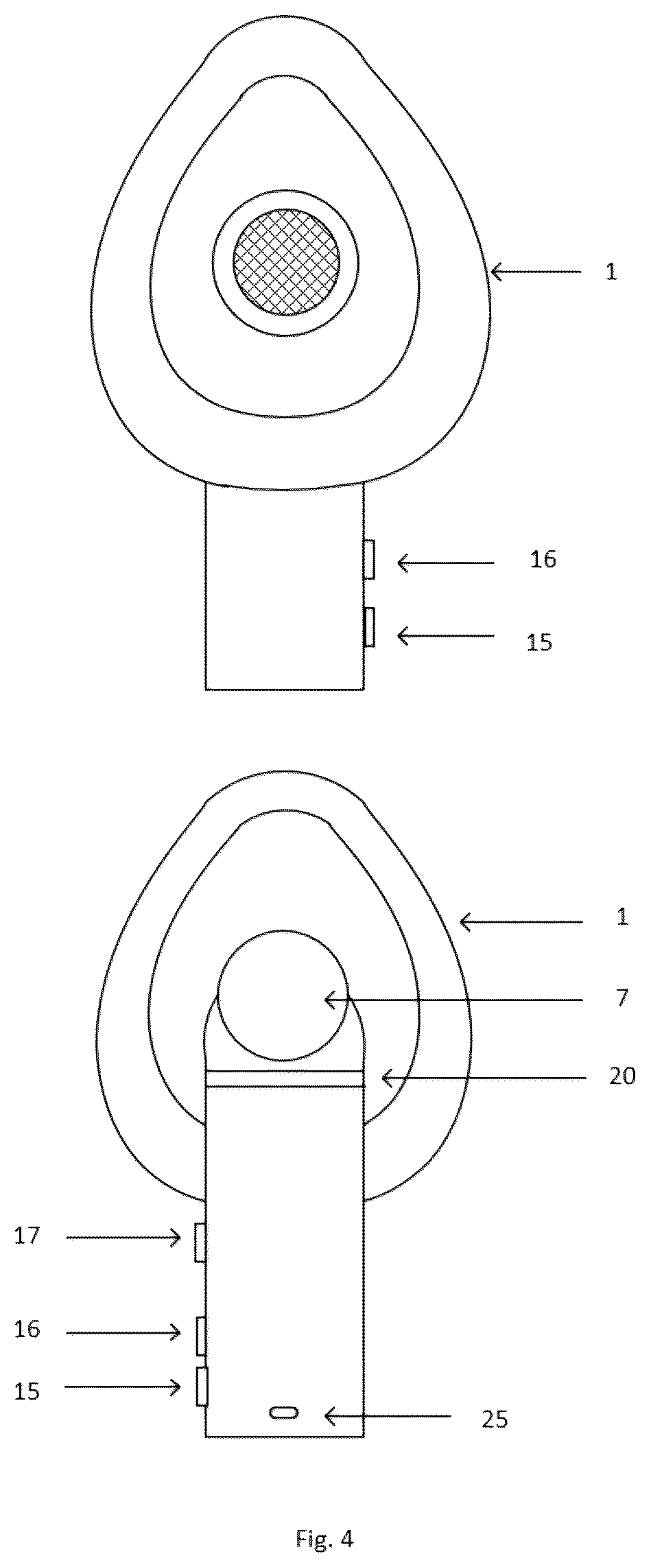 Patent US12599713 Figure 4 – Modular portable anti-choking device with advanced suction control