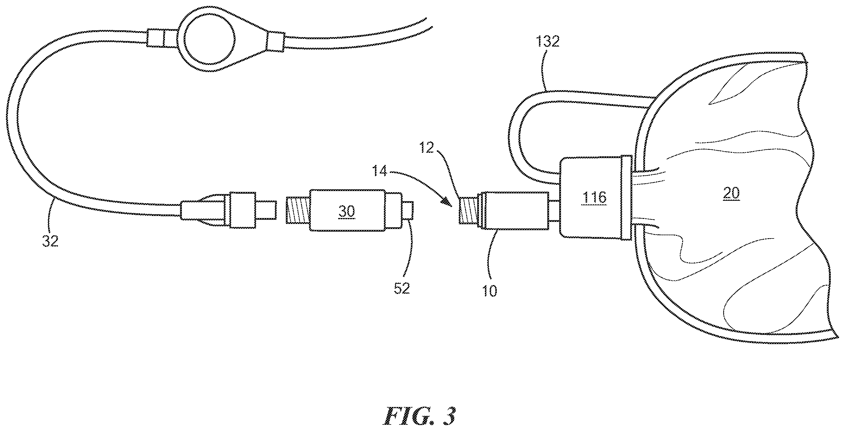 Patent US12599719 Figure 3 – Closed system elastomeric pumping mechanism
