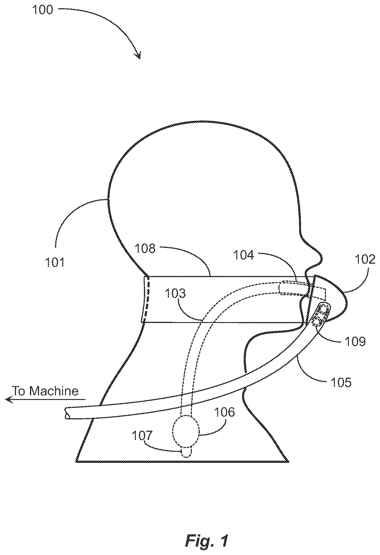 Patent US12599735 Figure 1 – Endotracheal tube attachment system