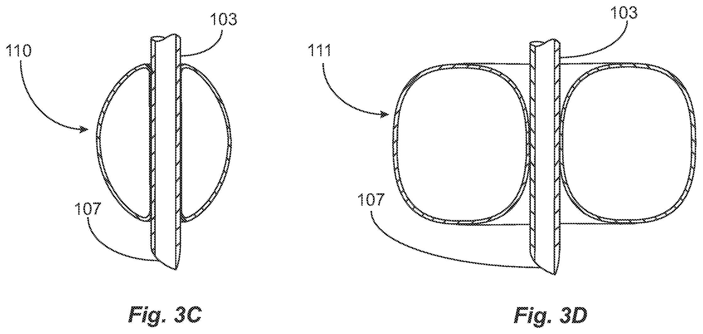 Patent US12599735 Figure 4 – Endotracheal tube attachment system