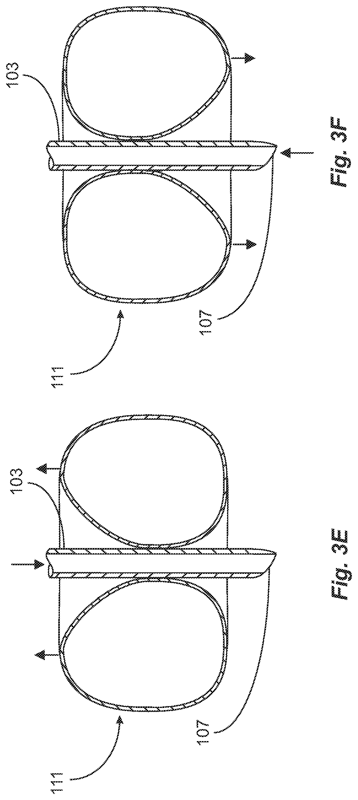 Patent US12599735 Figure 5 – Endotracheal tube attachment system