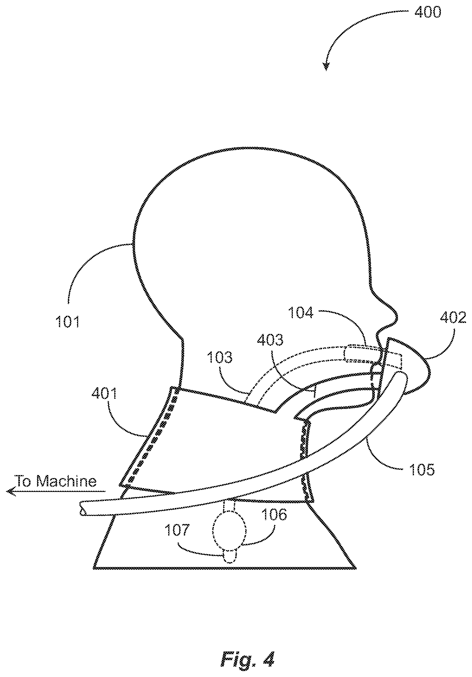 Patent US12599735 Figure 6 – Endotracheal tube attachment system