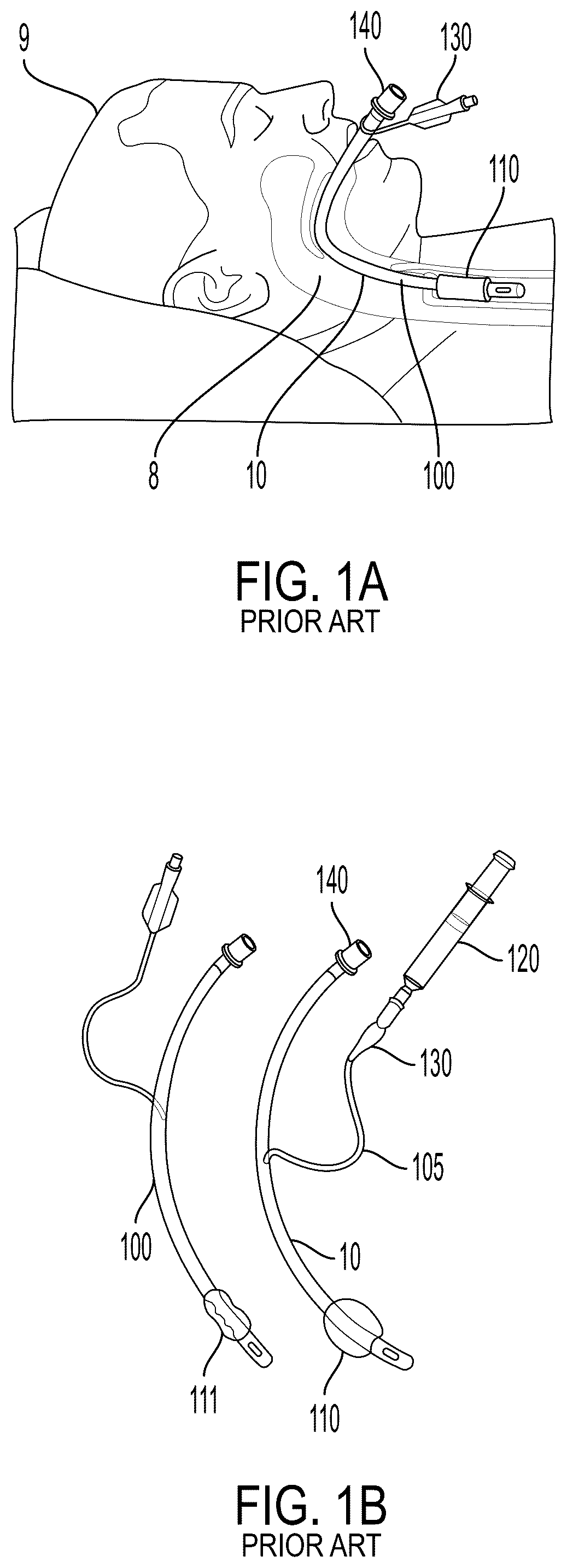 Patent US12599736 Figure 1 – System and method for avoiding leakage in endotracheal tube with single or double cuff