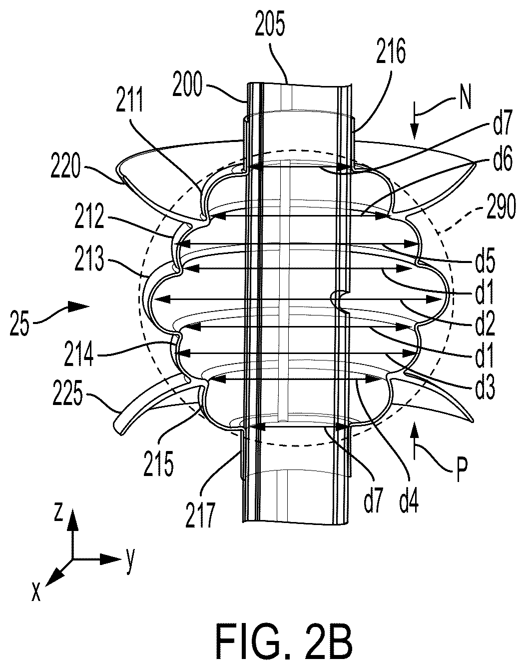 Patent US12599736 Figure 3 – System and method for avoiding leakage in endotracheal tube with single or double cuff
