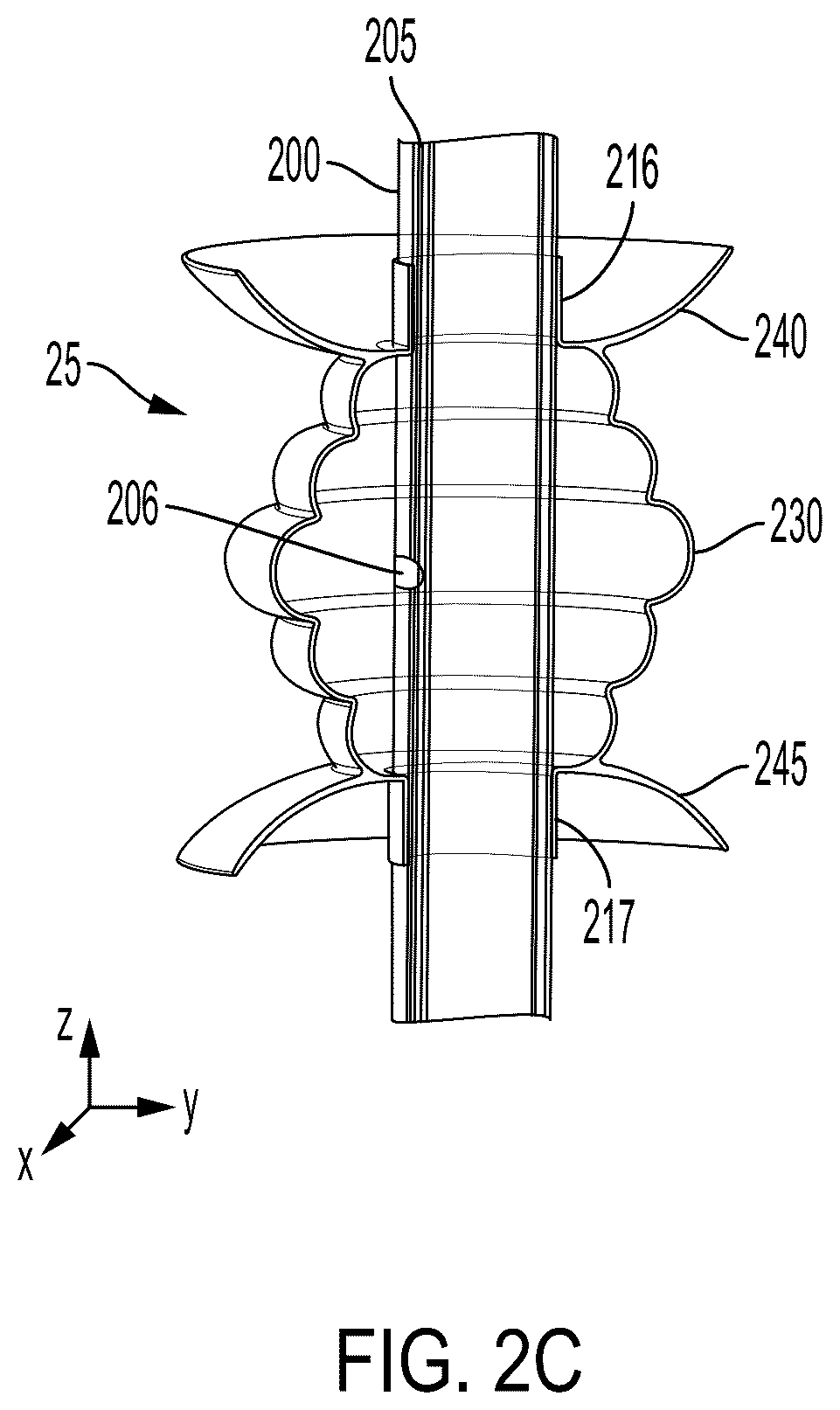 Patent US12599736 Figure 4 – System and method for avoiding leakage in endotracheal tube with single or double cuff