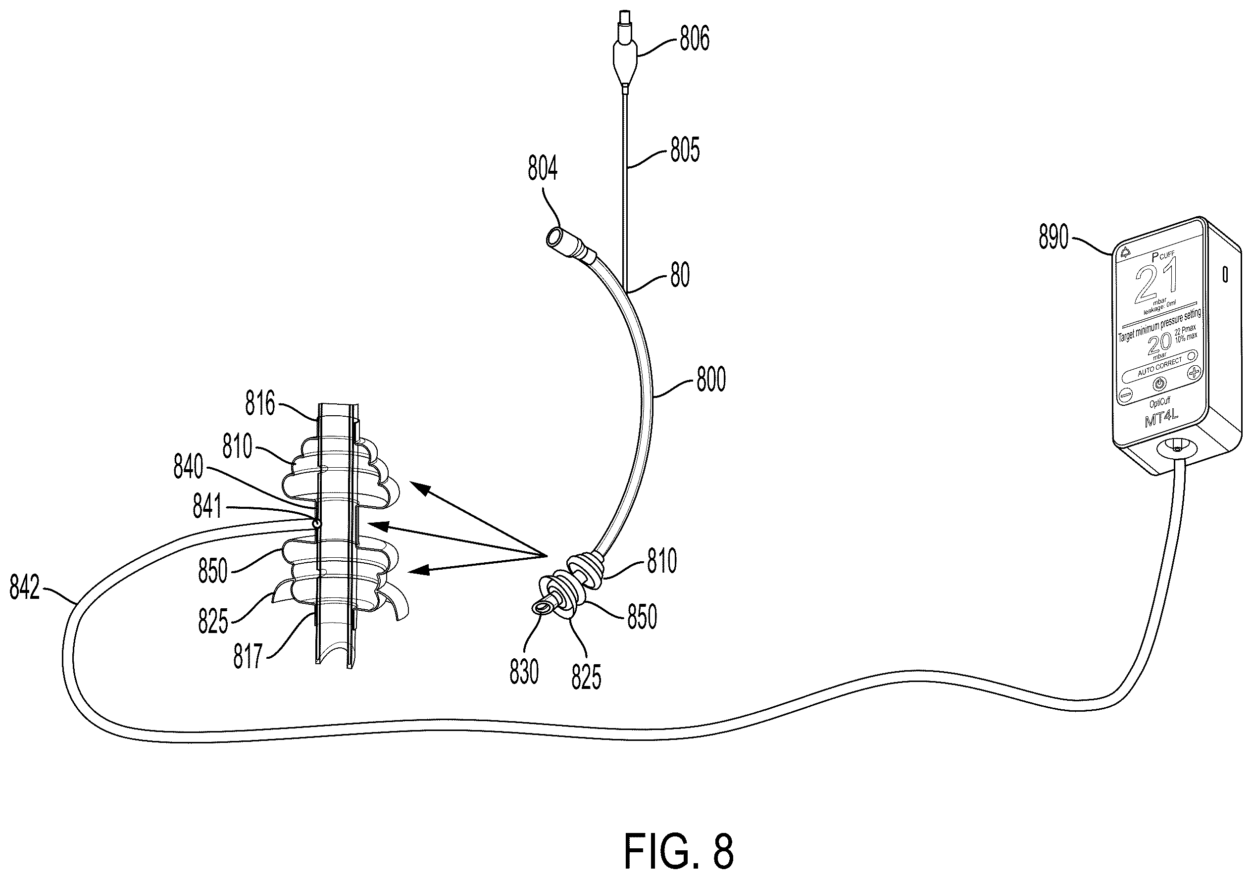 Patent US12599736 Figure 11 – System and method for avoiding leakage in endotracheal tube with single or double cuff