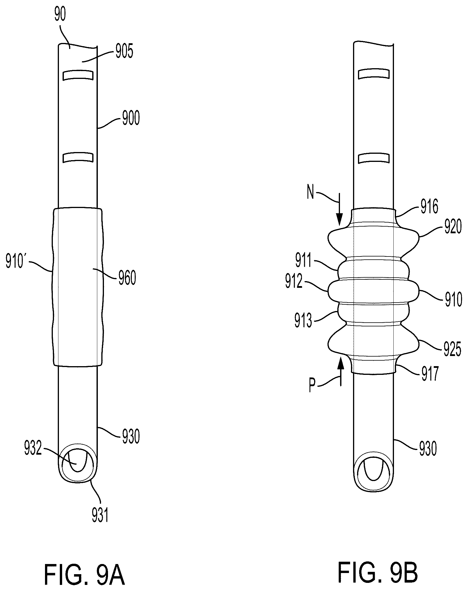 Patent US12599736 Figure 12 – System and method for avoiding leakage in endotracheal tube with single or double cuff