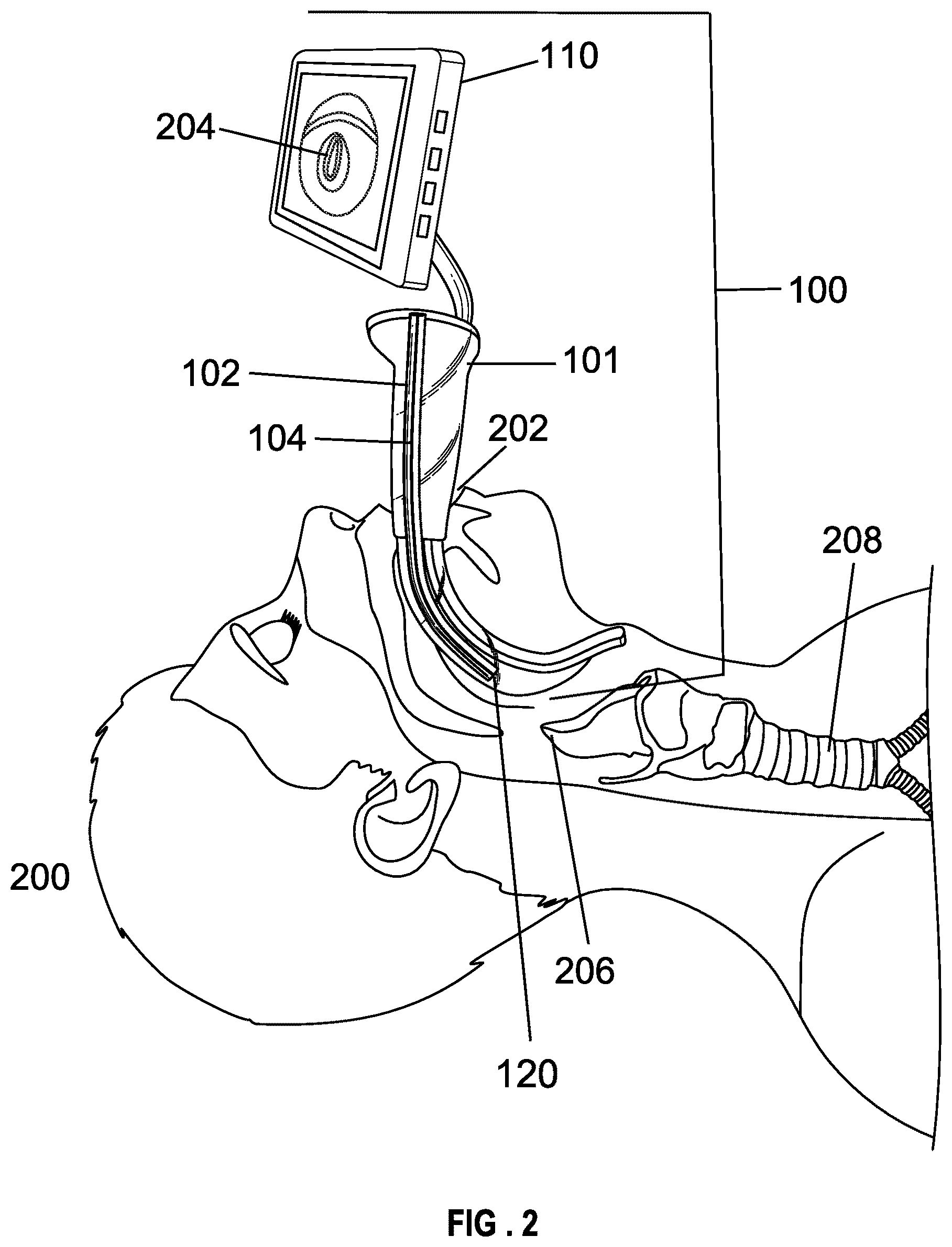 Patent US12599737 Figure 2 – Laryngoscope blade with a channel