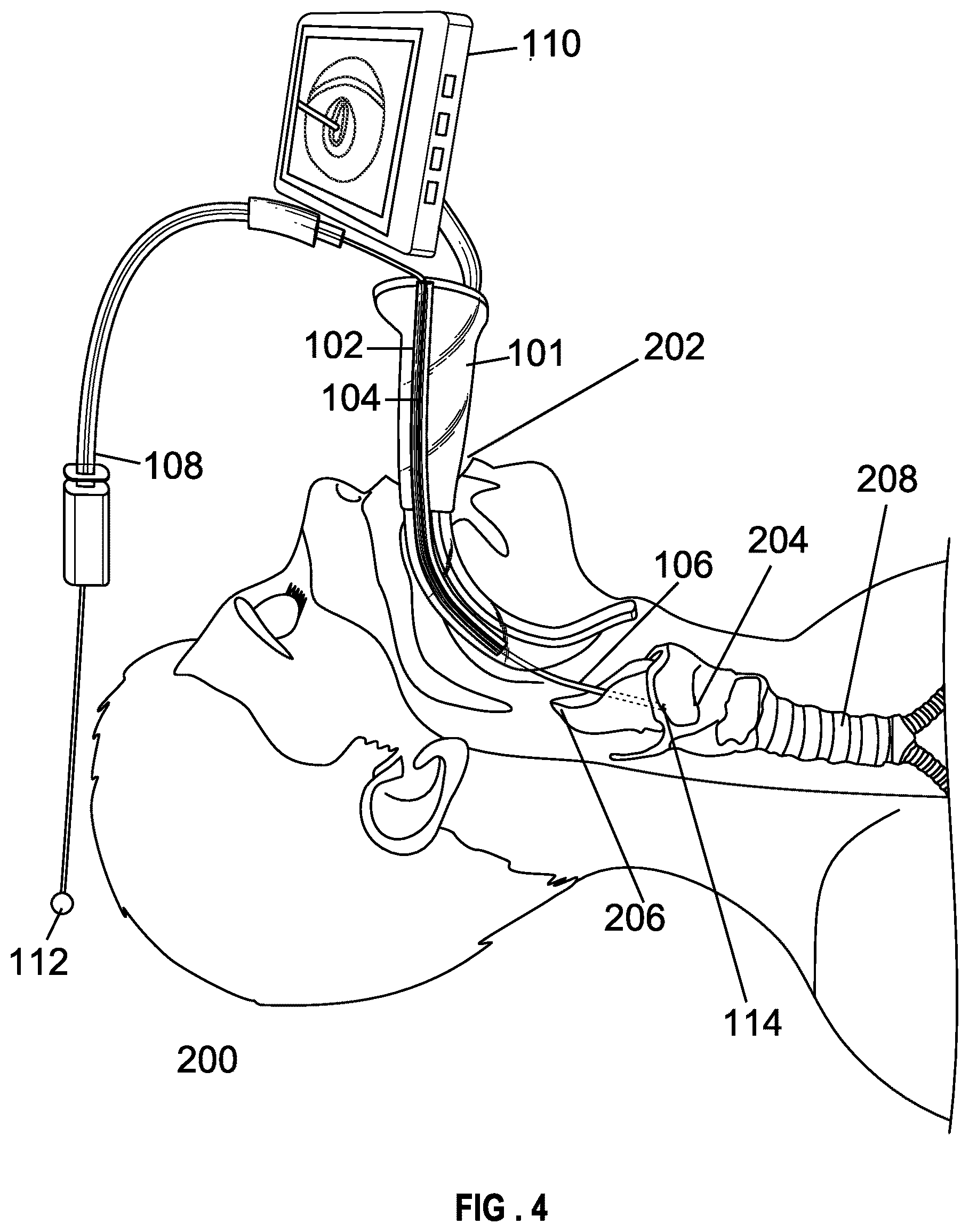 Patent US12599737 Figure 4 – Laryngoscope blade with a channel