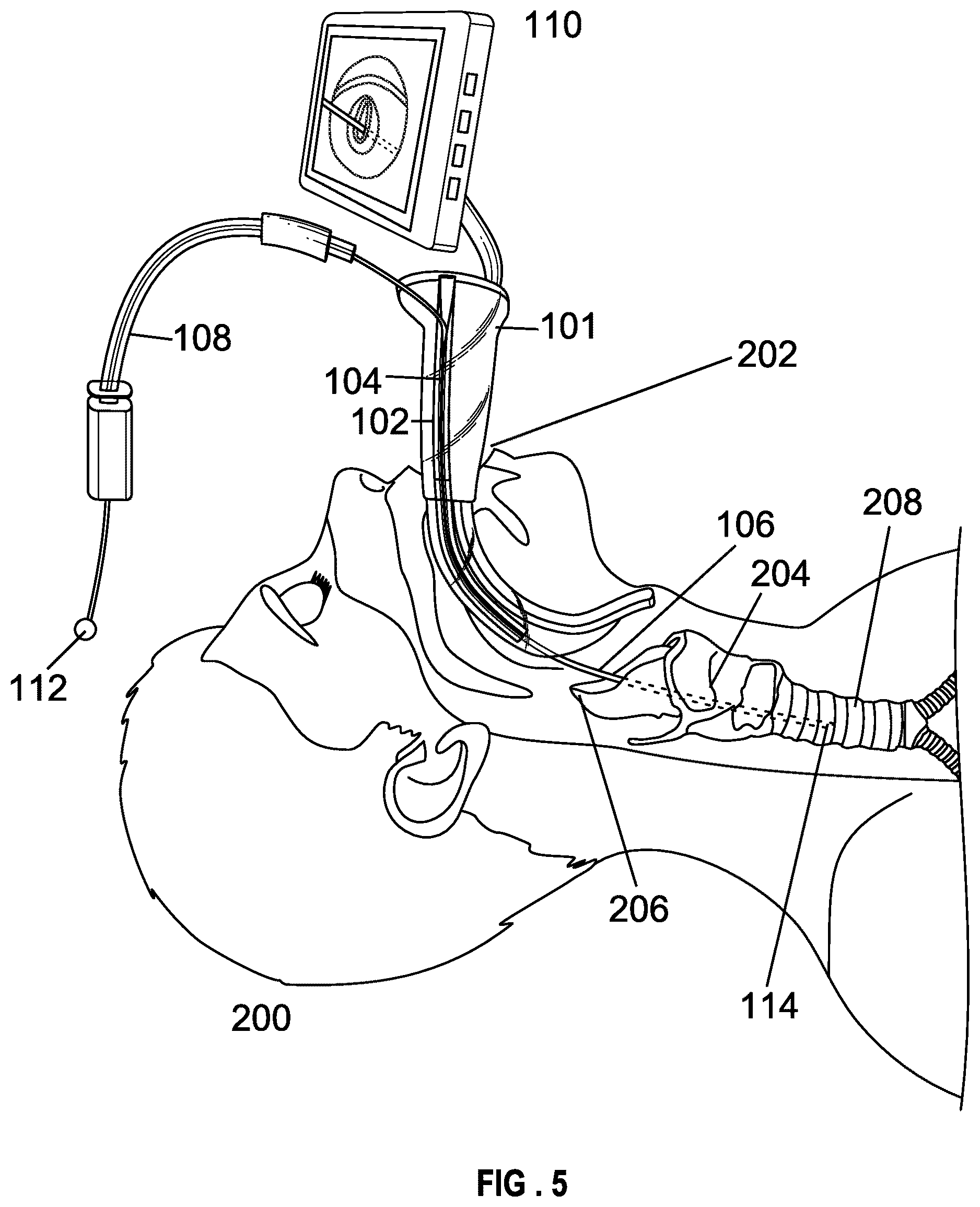 Patent US12599737 Figure 5 – Laryngoscope blade with a channel