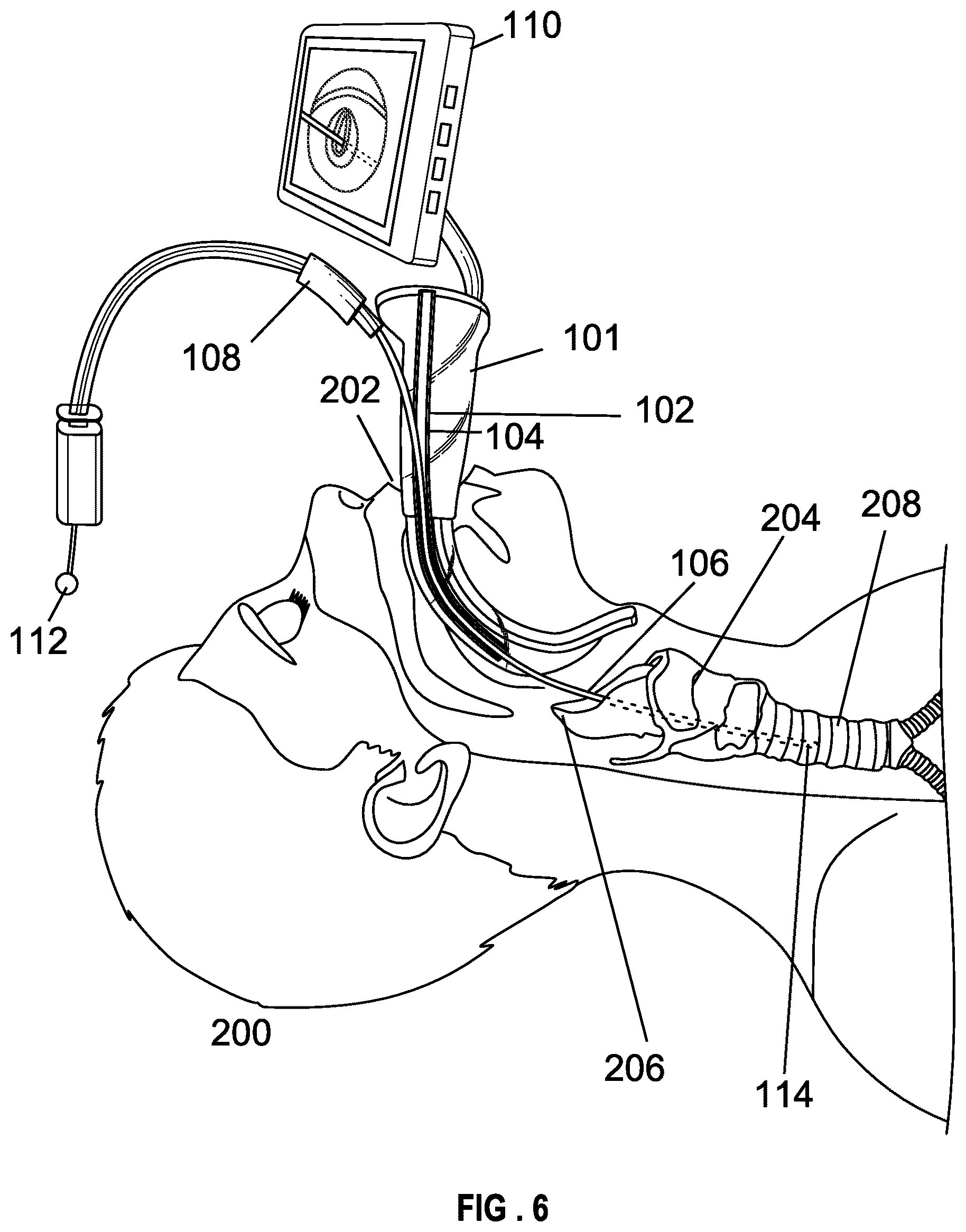Patent US12599737 Figure 6 – Laryngoscope blade with a channel