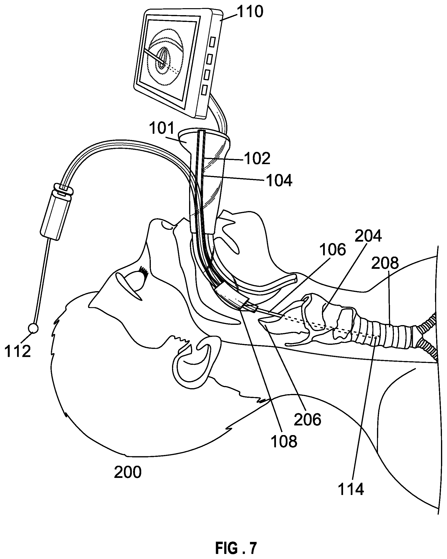 Patent US12599737 Figure 7 – Laryngoscope blade with a channel