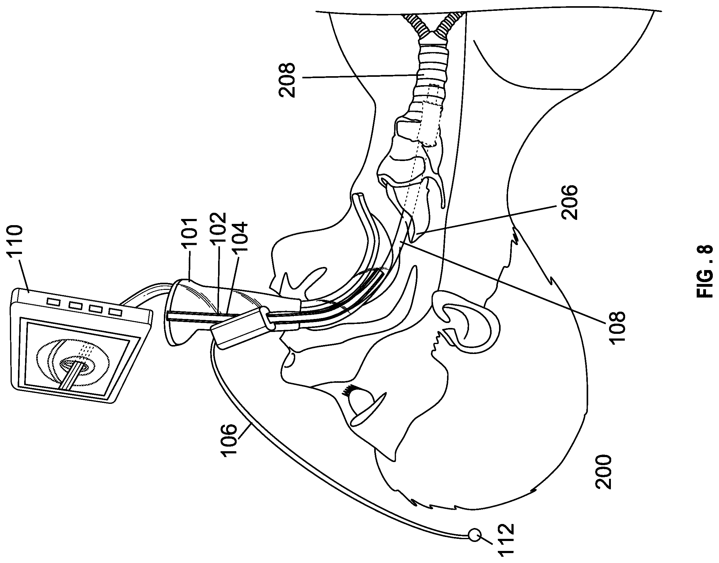 Patent US12599737 Figure 8 – Laryngoscope blade with a channel