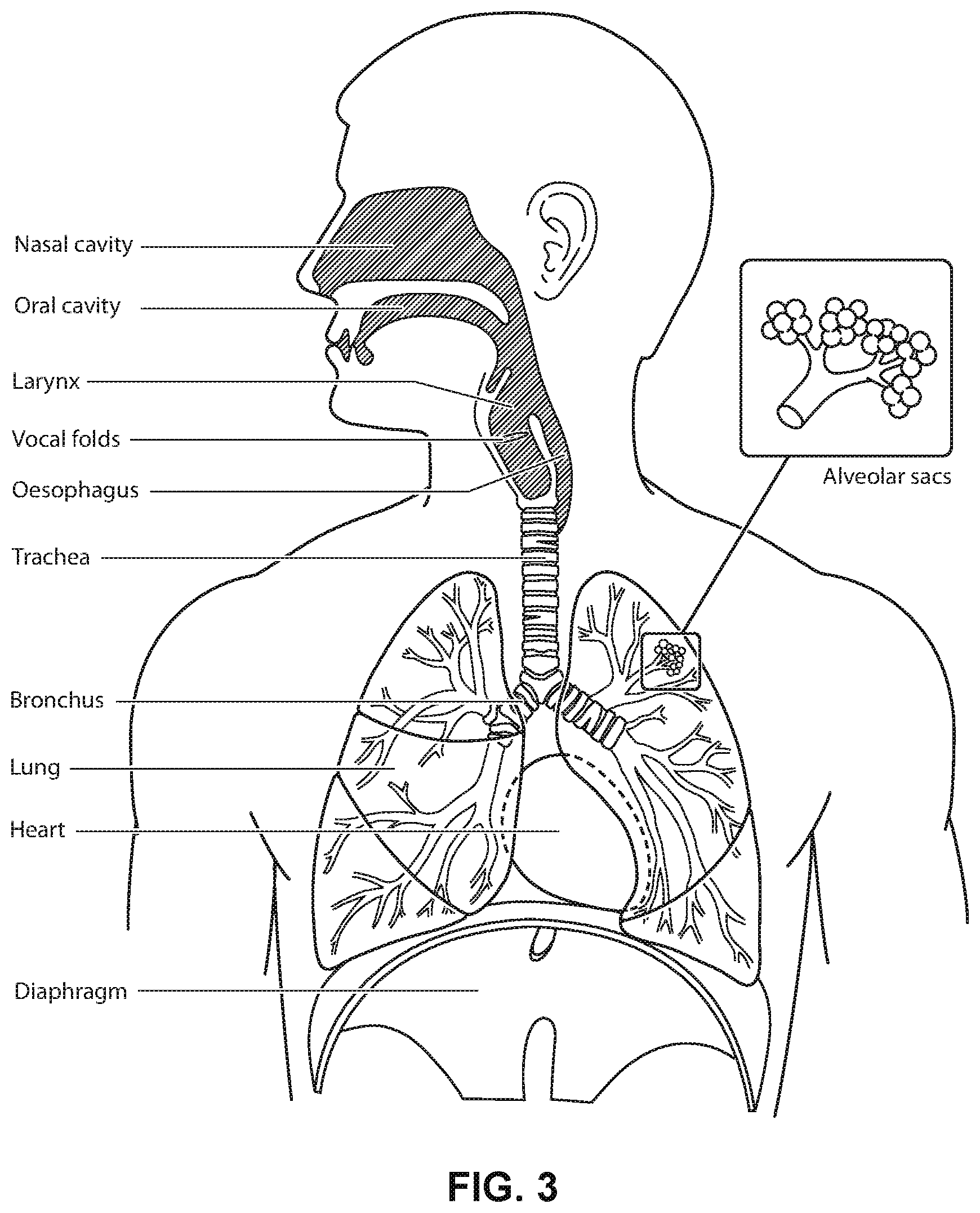 Patent US12599739 Figure 3 – Patient interface with foam cushion