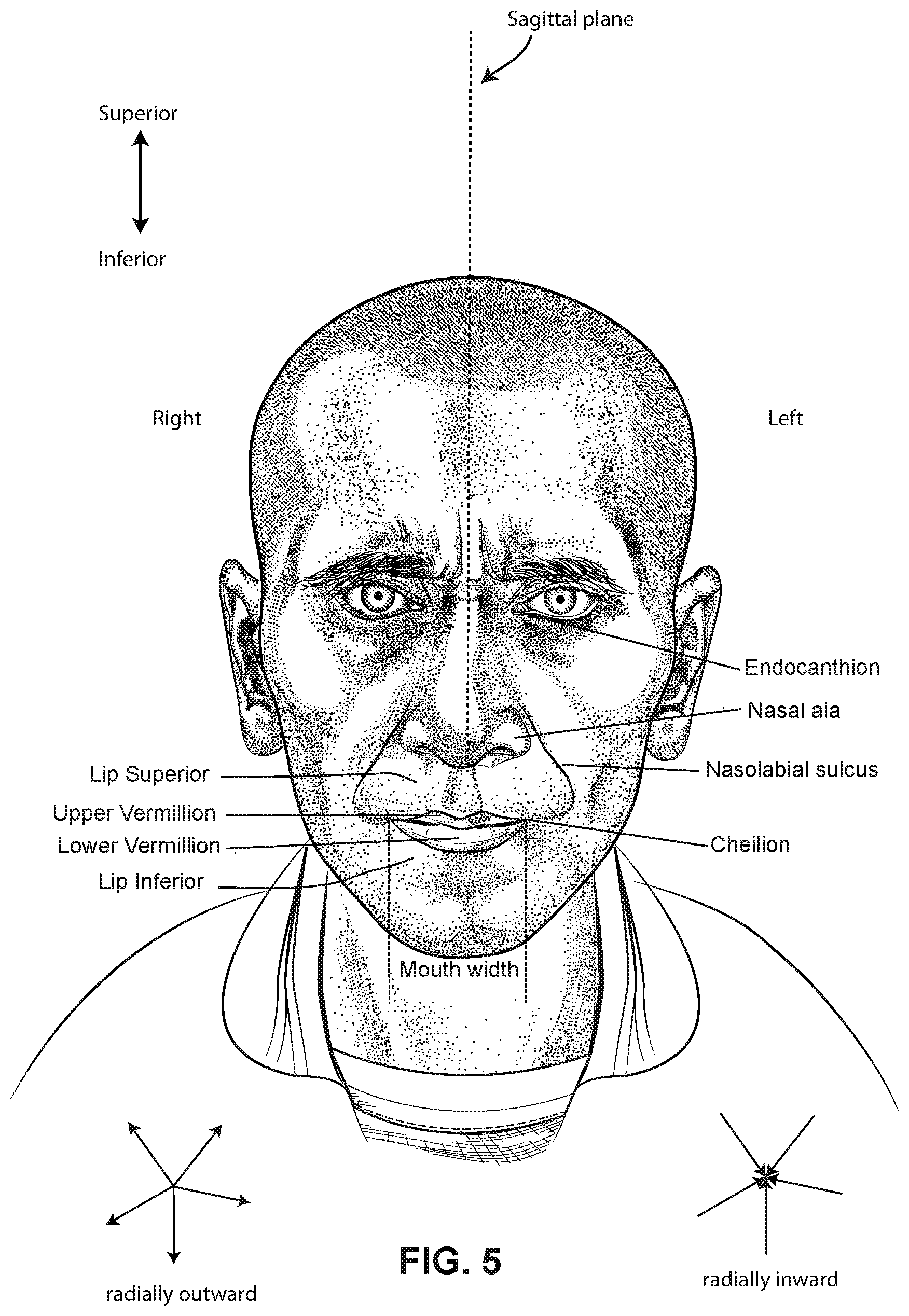 Patent US12599739 Figure 5 – Patient interface with foam cushion