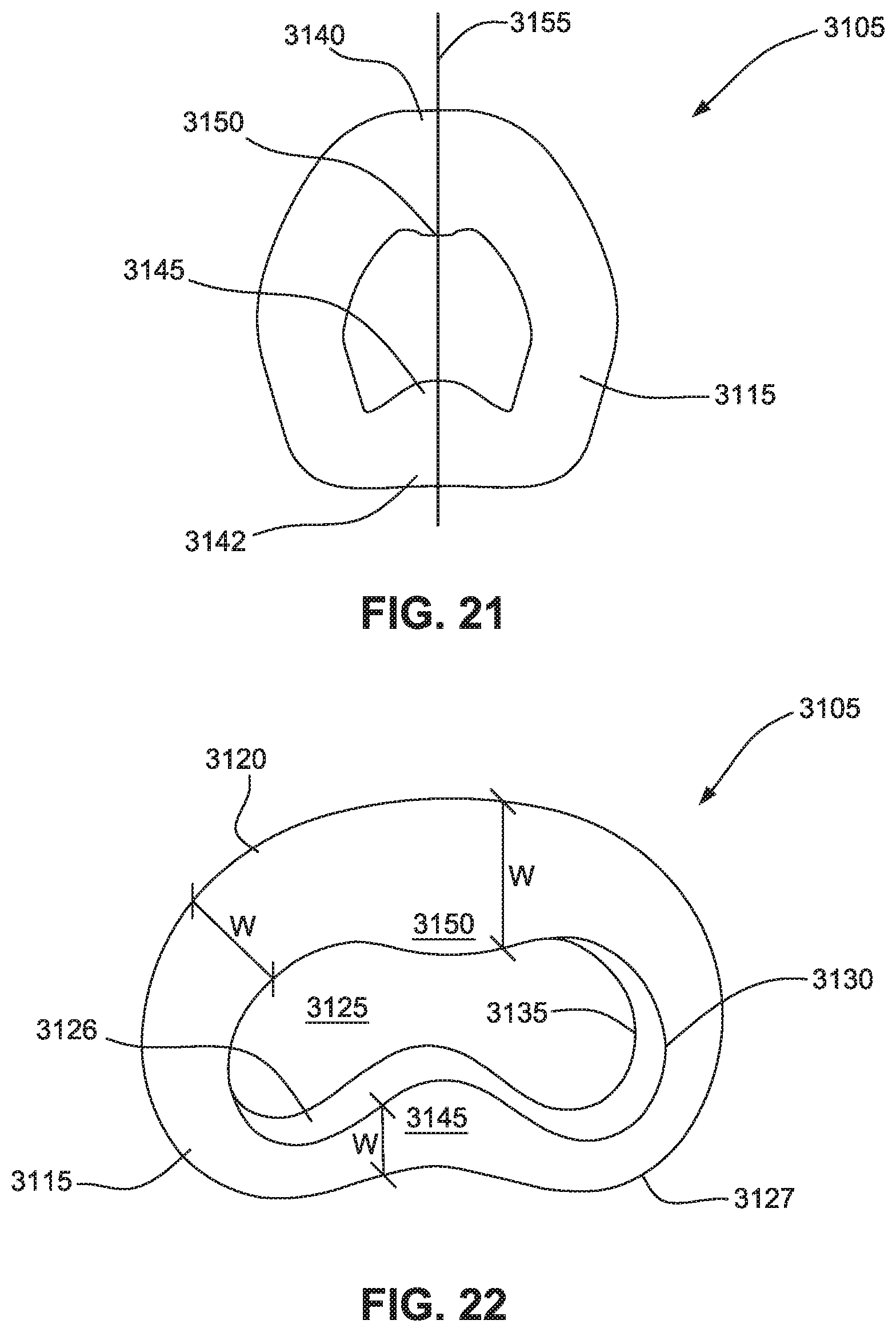 Patent US12599739 Figure 16 – Patient interface with foam cushion