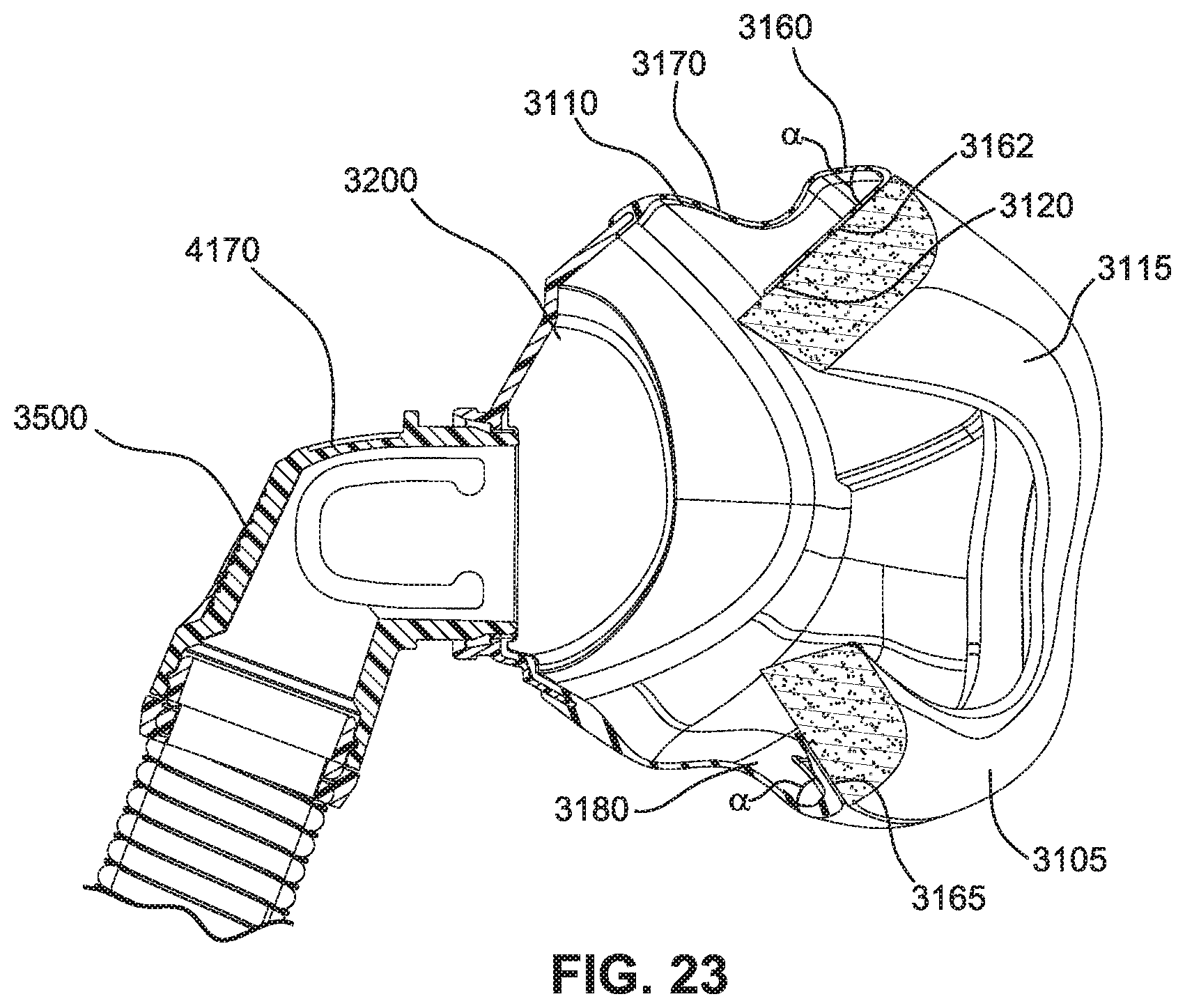 Patent US12599739 Figure 17 – Patient interface with foam cushion