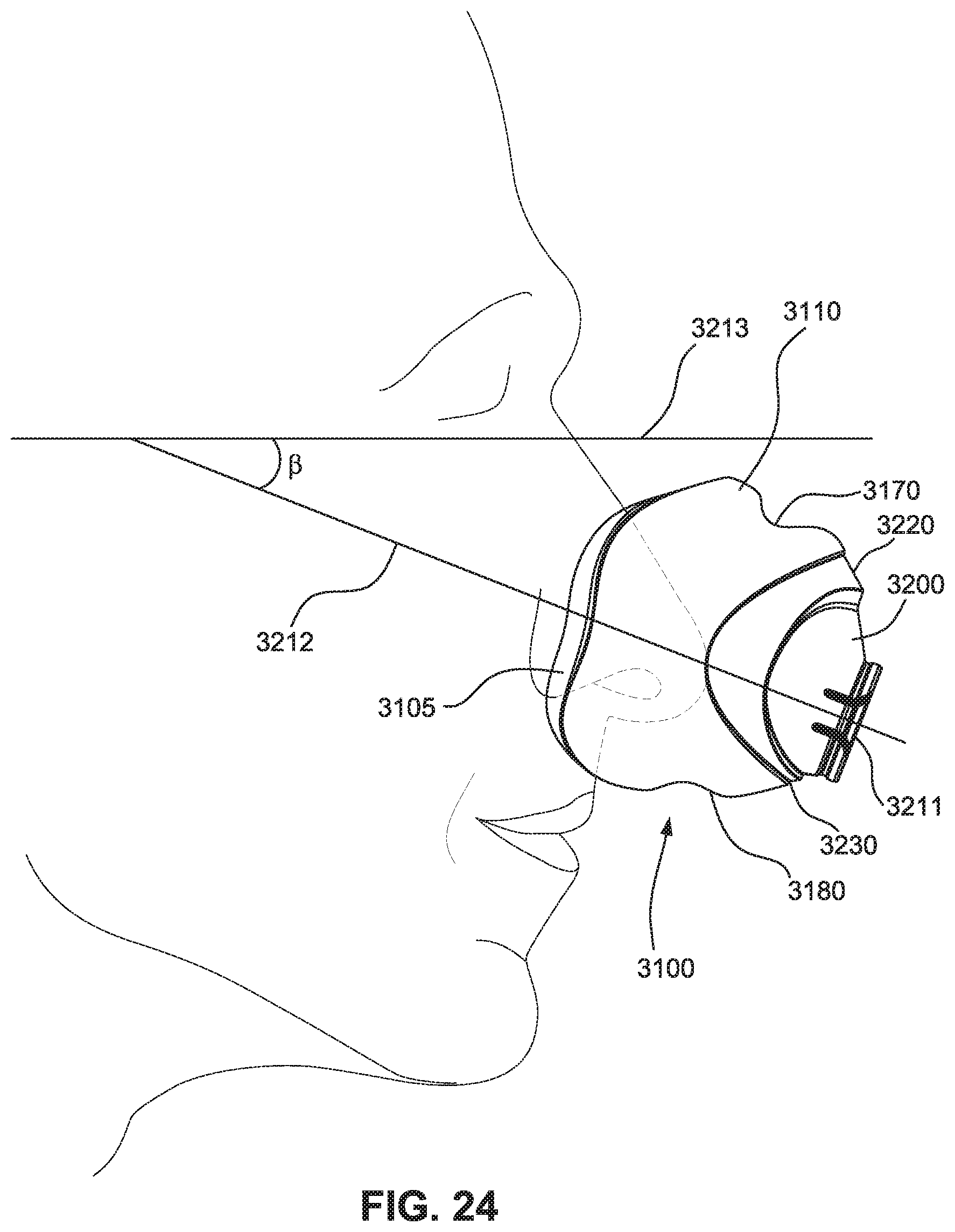 Patent US12599739 Figure 18 – Patient interface with foam cushion