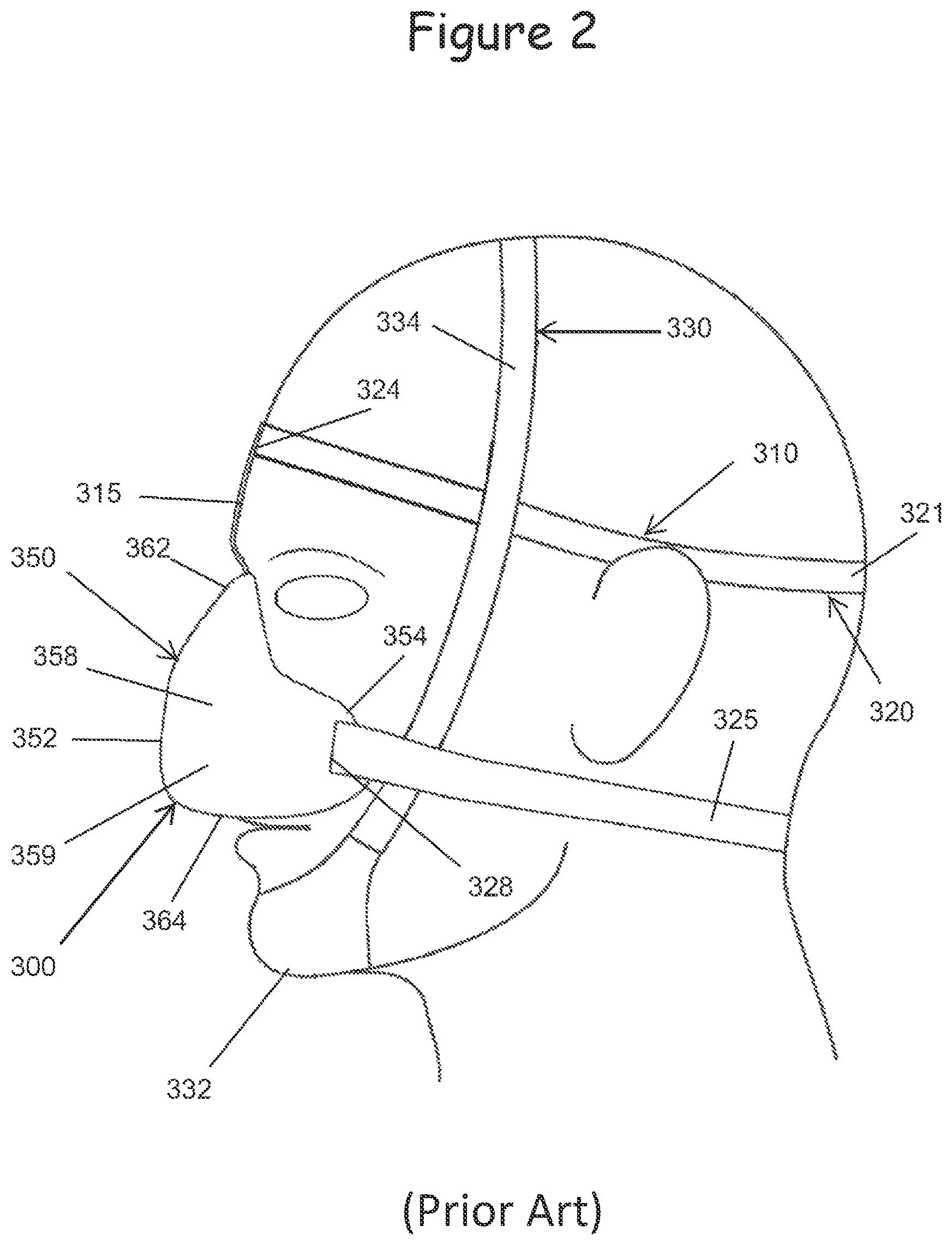 Patent US12599740 Figure 2 – Oral appliance for use with CPAP headgear