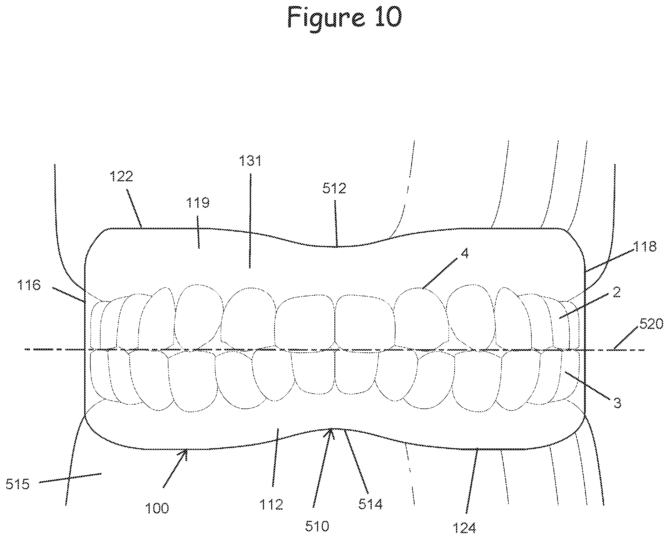 Patent US12599740 Figure 10 – Oral appliance for use with CPAP headgear
