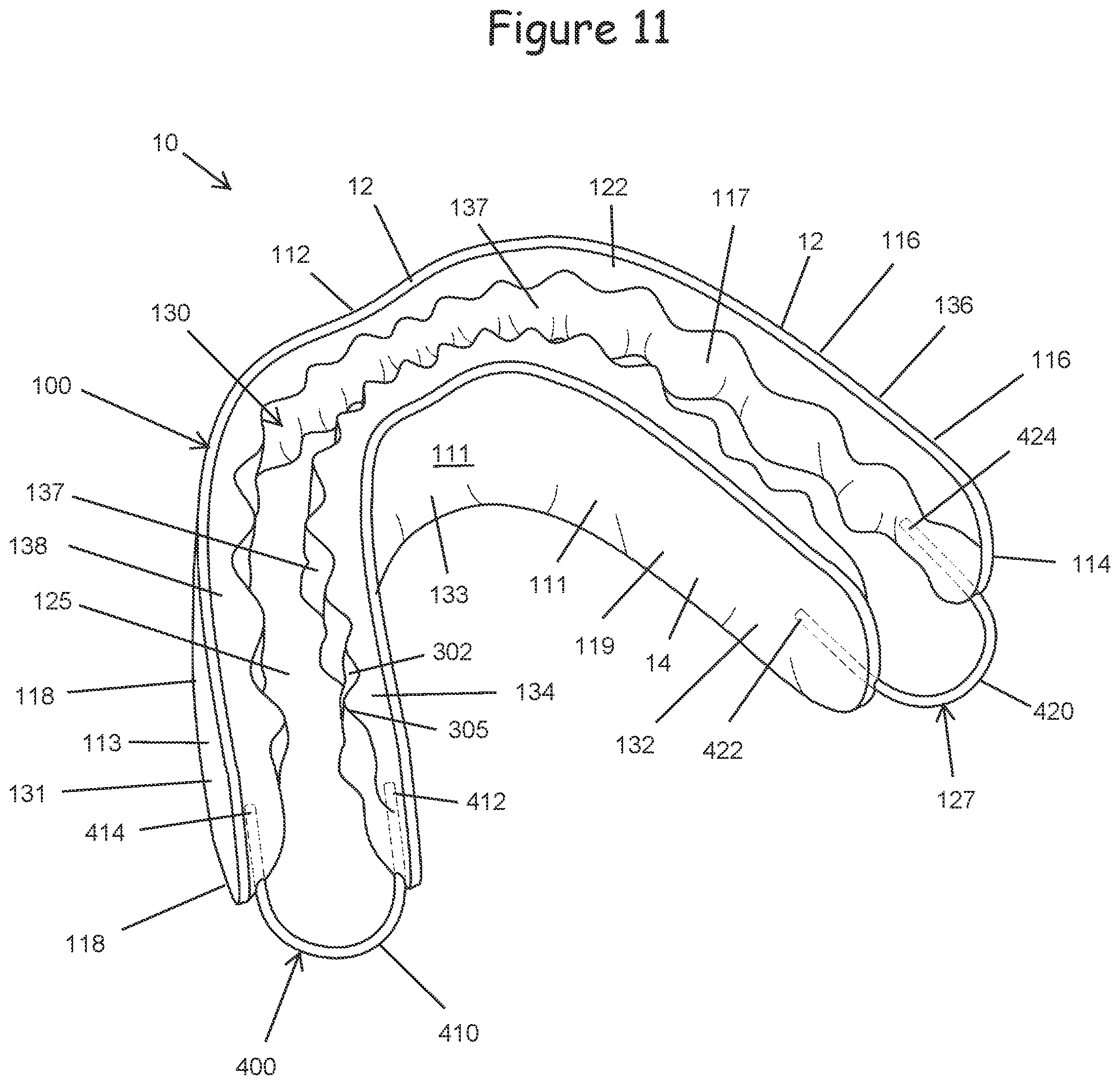 Patent US12599740 Figure 11 – Oral appliance for use with CPAP headgear