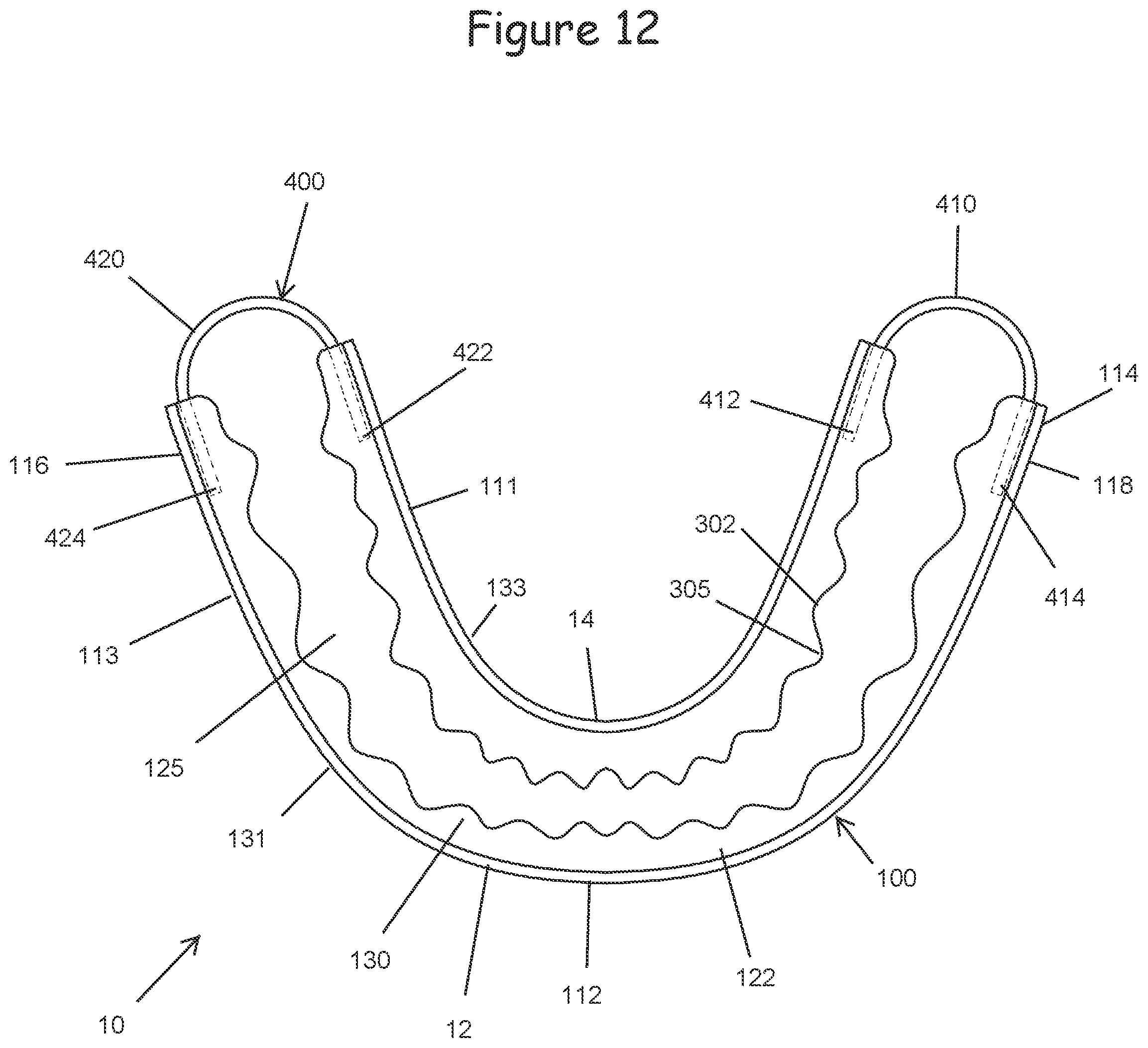 Patent US12599740 Figure 12 – Oral appliance for use with CPAP headgear