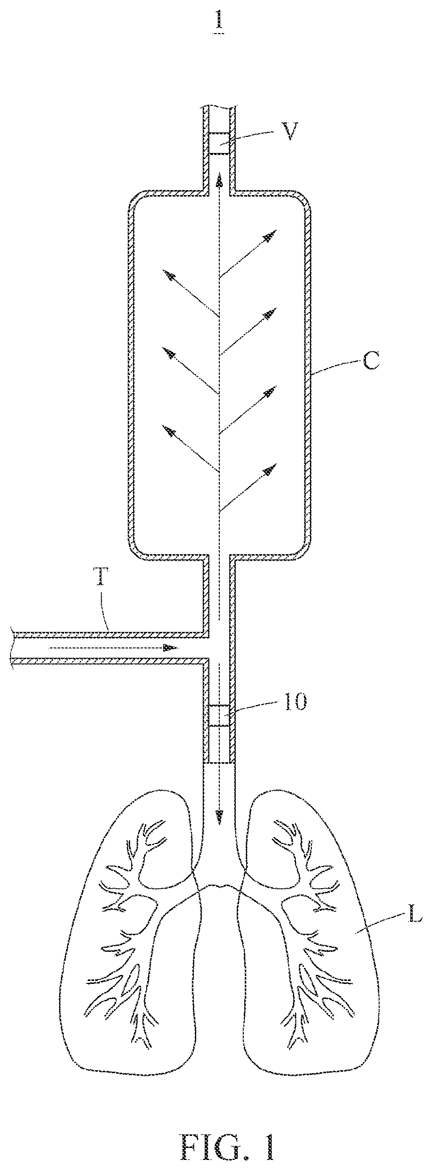Patent US12599743 Figure 1 – Bidirectional flow-controllable artificial respirator